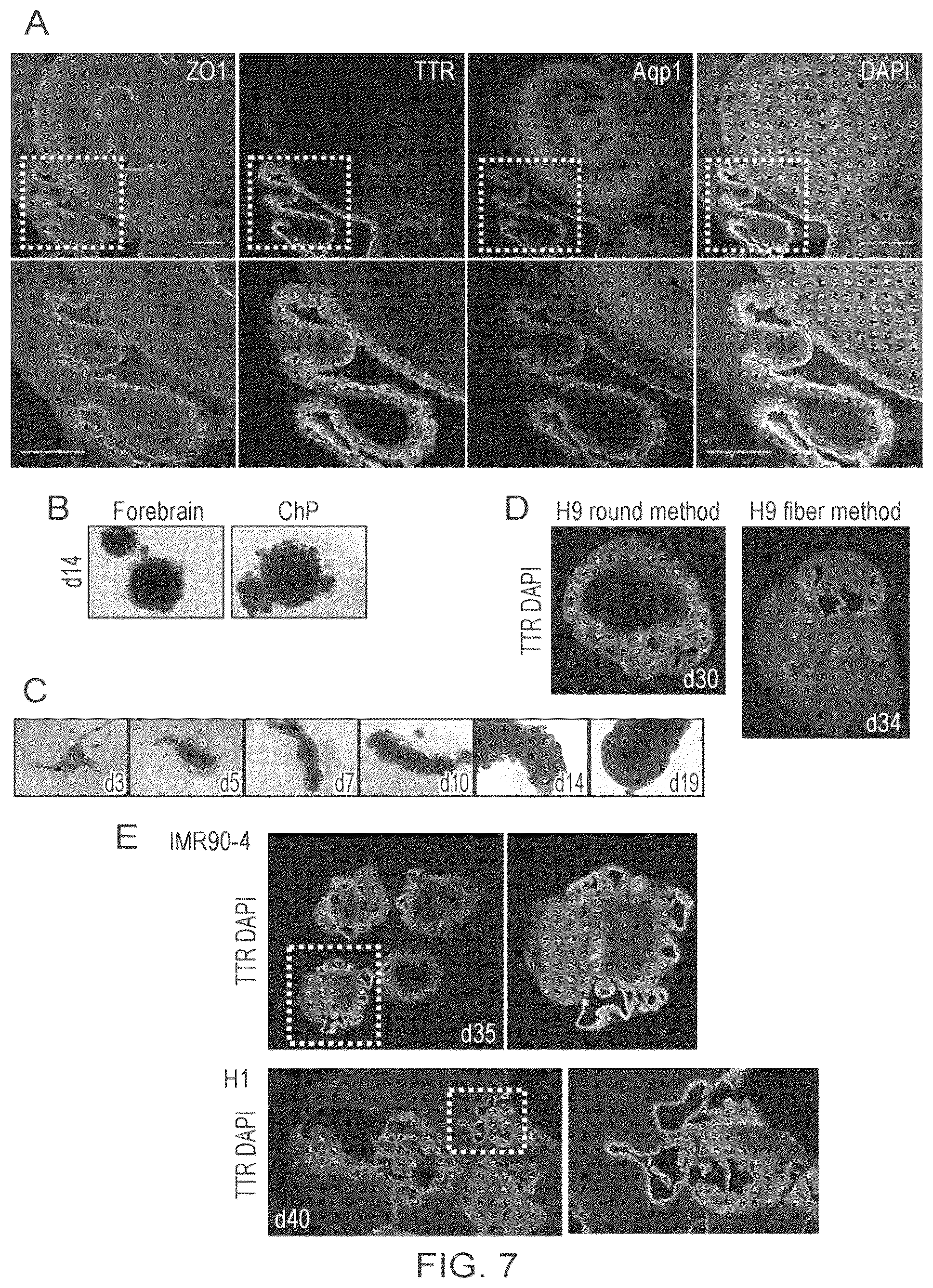 Patent US12410407 Figure 17 – Choroid plexus organoids and methods for production thereof