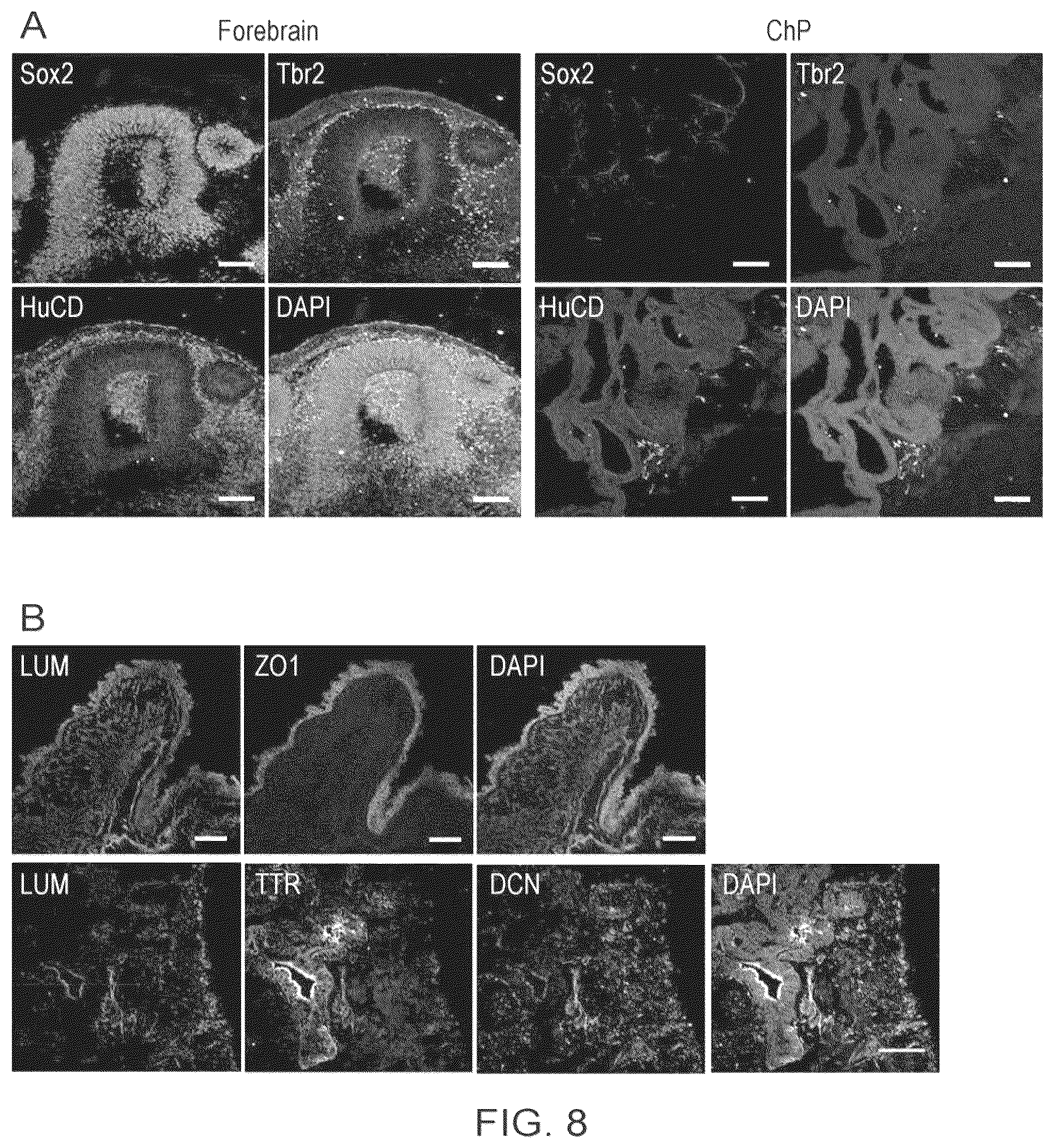Patent US12410407 Figure 18 – Choroid plexus organoids and methods for production thereof