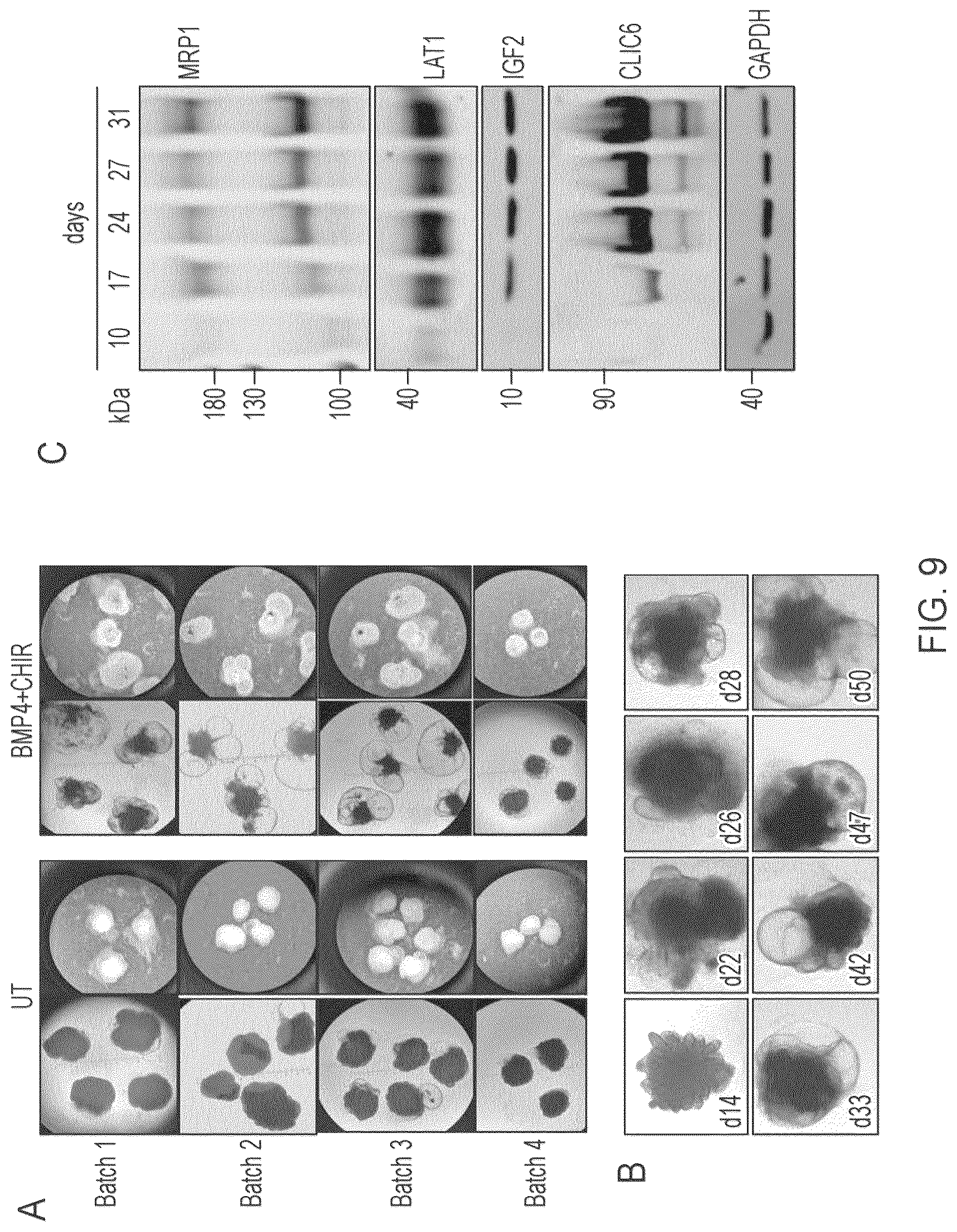 Patent US12410407 Figure 19 – Choroid plexus organoids and methods for production thereof