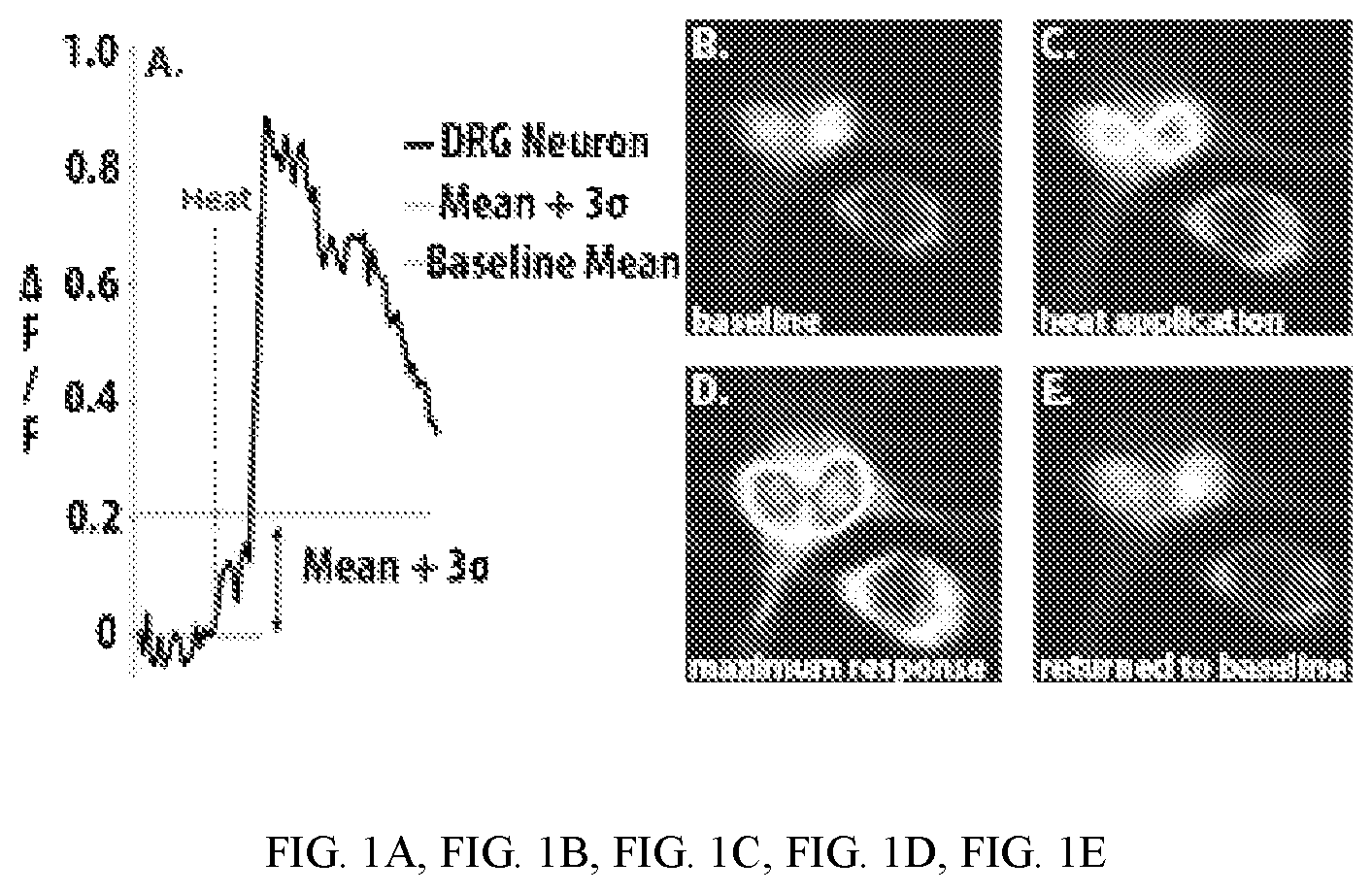 Patent US12410428 Figure 1 – RNA-guided transcriptional regulation and methods of using the same for the treatment of back pain