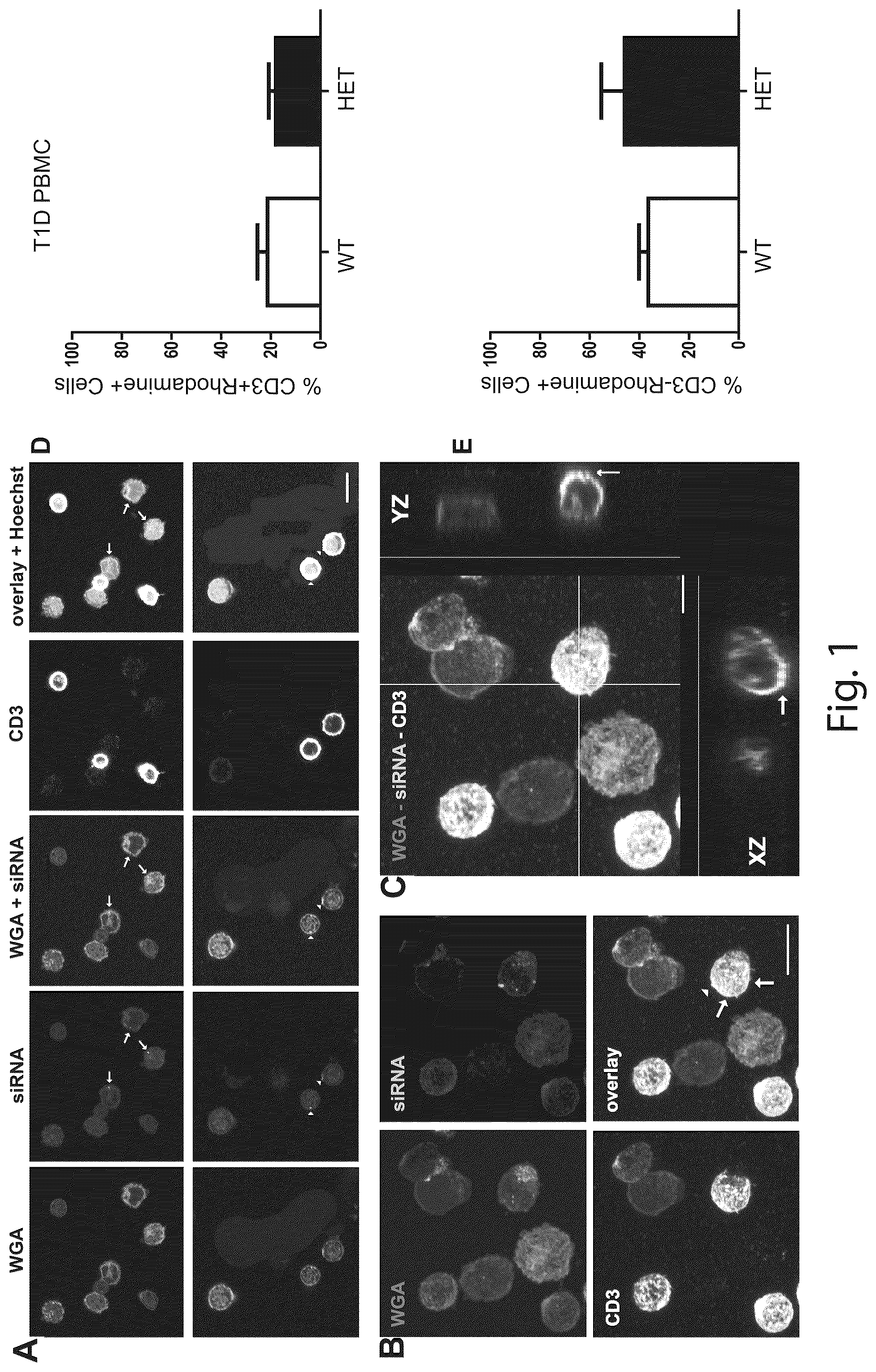 Patent US12410431 — Short interfering RNA targeting variant C1858T of gene PTPN22 — Figure 1