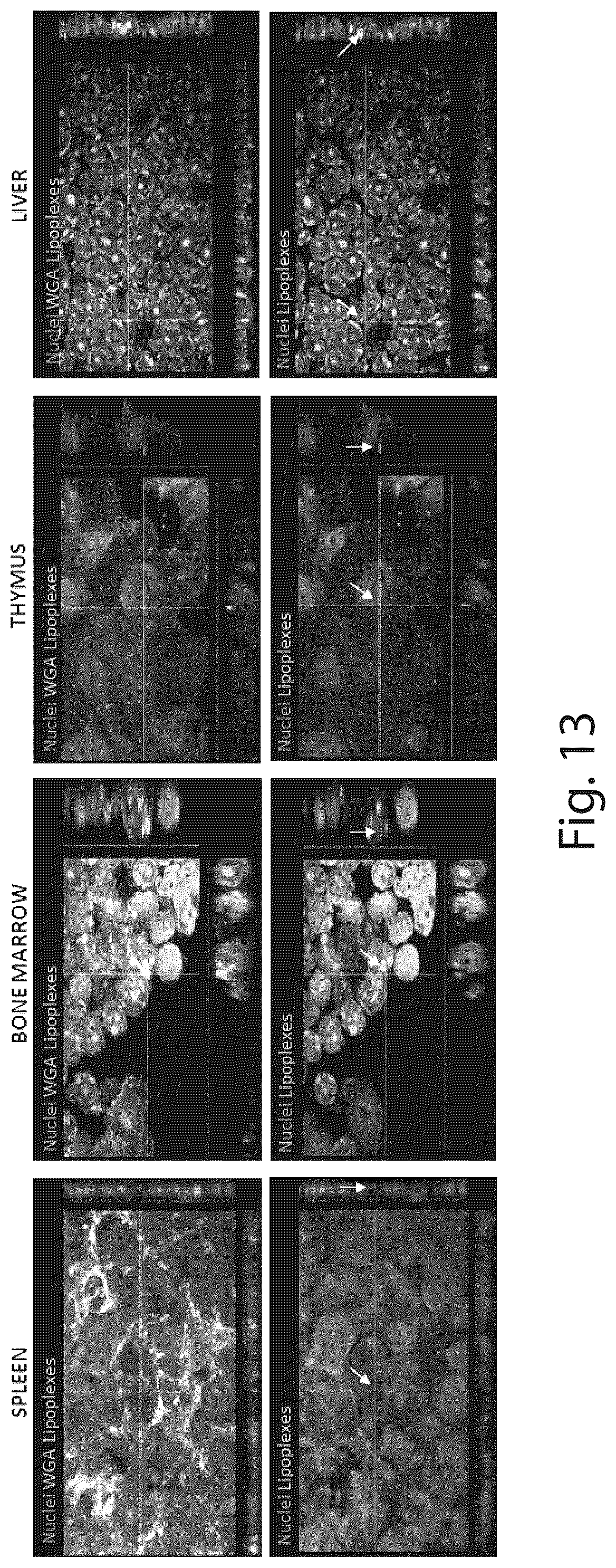 Patent US12410431 Figure 13 – Short interfering RNA targeting variant C1858T of gene PTPN22