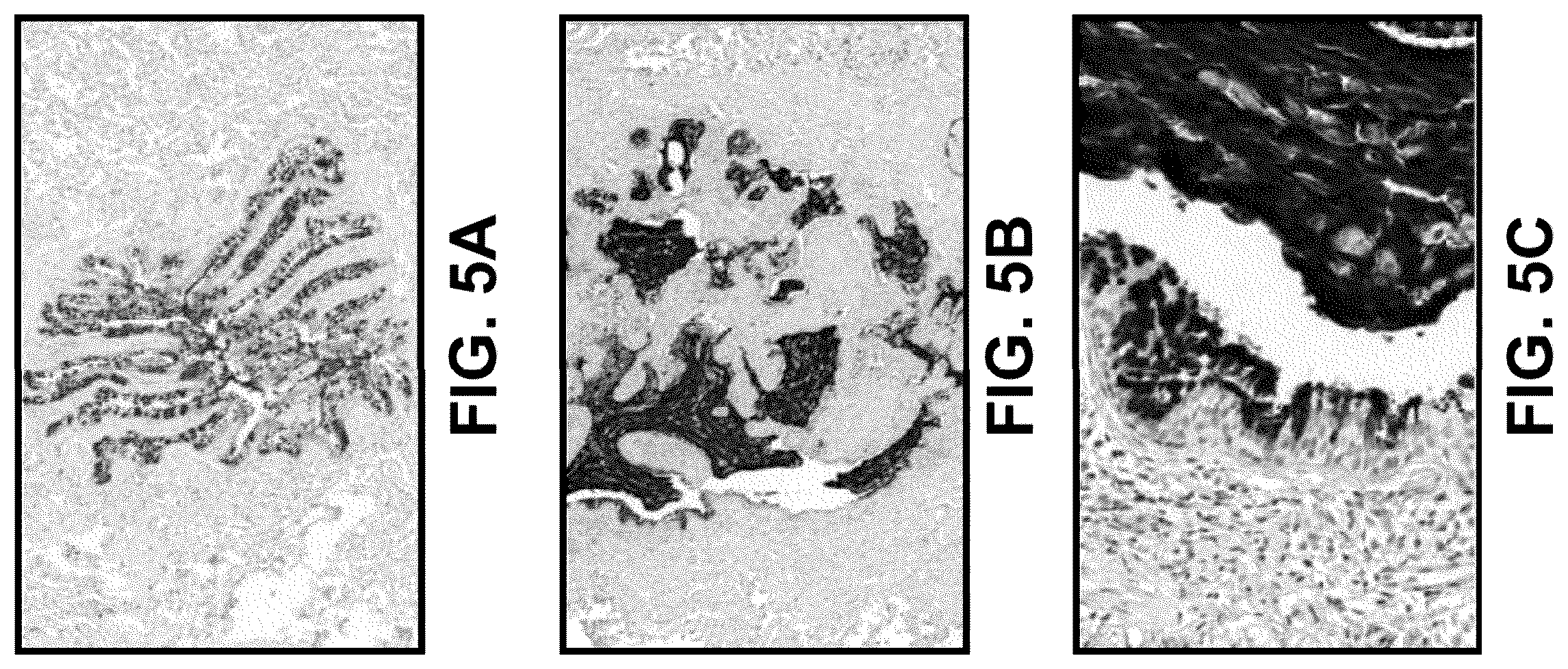 Patent US12410477 Figure 5 – Methods and compositions for risk prediction, diagnosis, prognosis, and treatment of pulmonary disorders