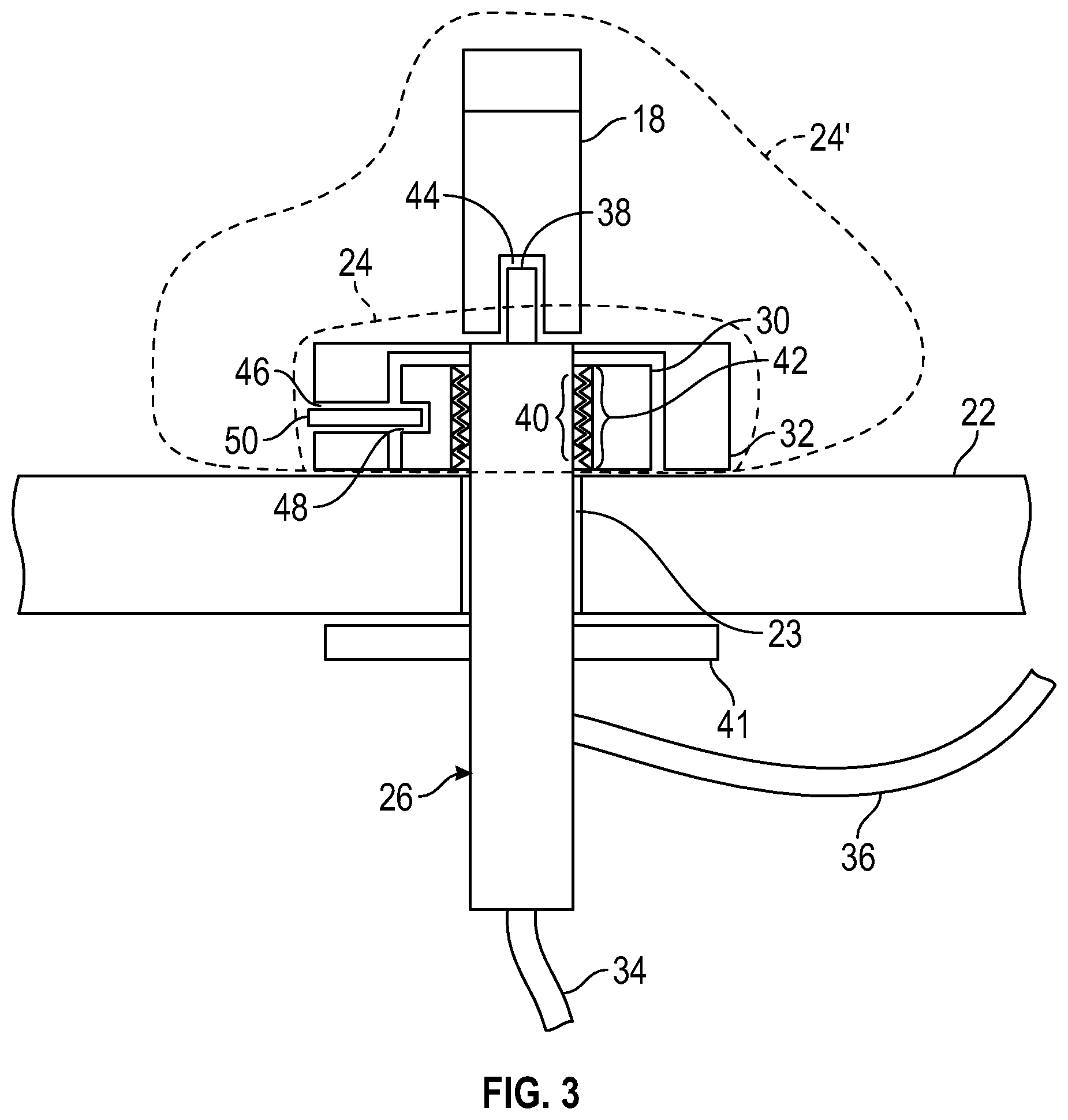 Patent US12410593 Figure 4 – Mounting assembly for use with a plumbing fixture