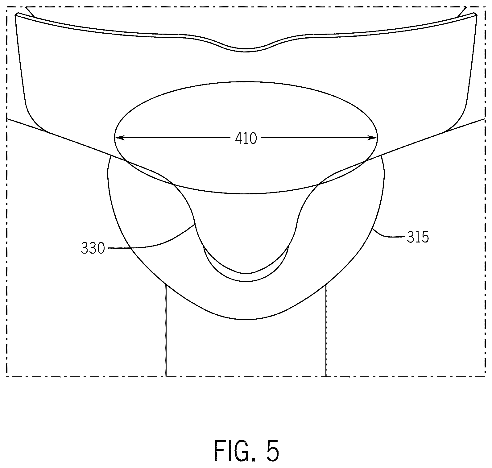 Patent US12410600 Figure 5 – Toilet with canned sump