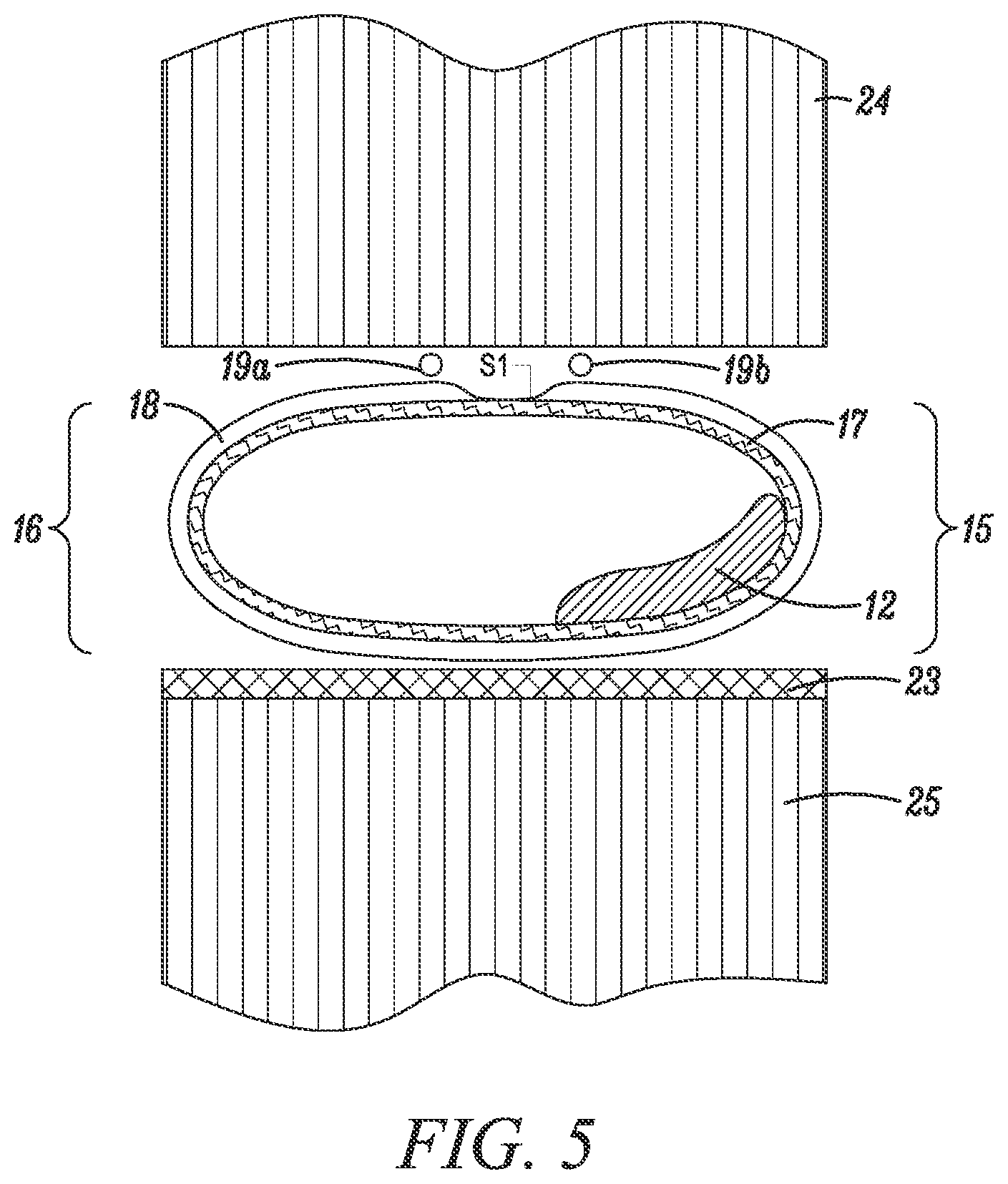Patent US12410607 Figure 4 – Foam envelope for sealing large volumes