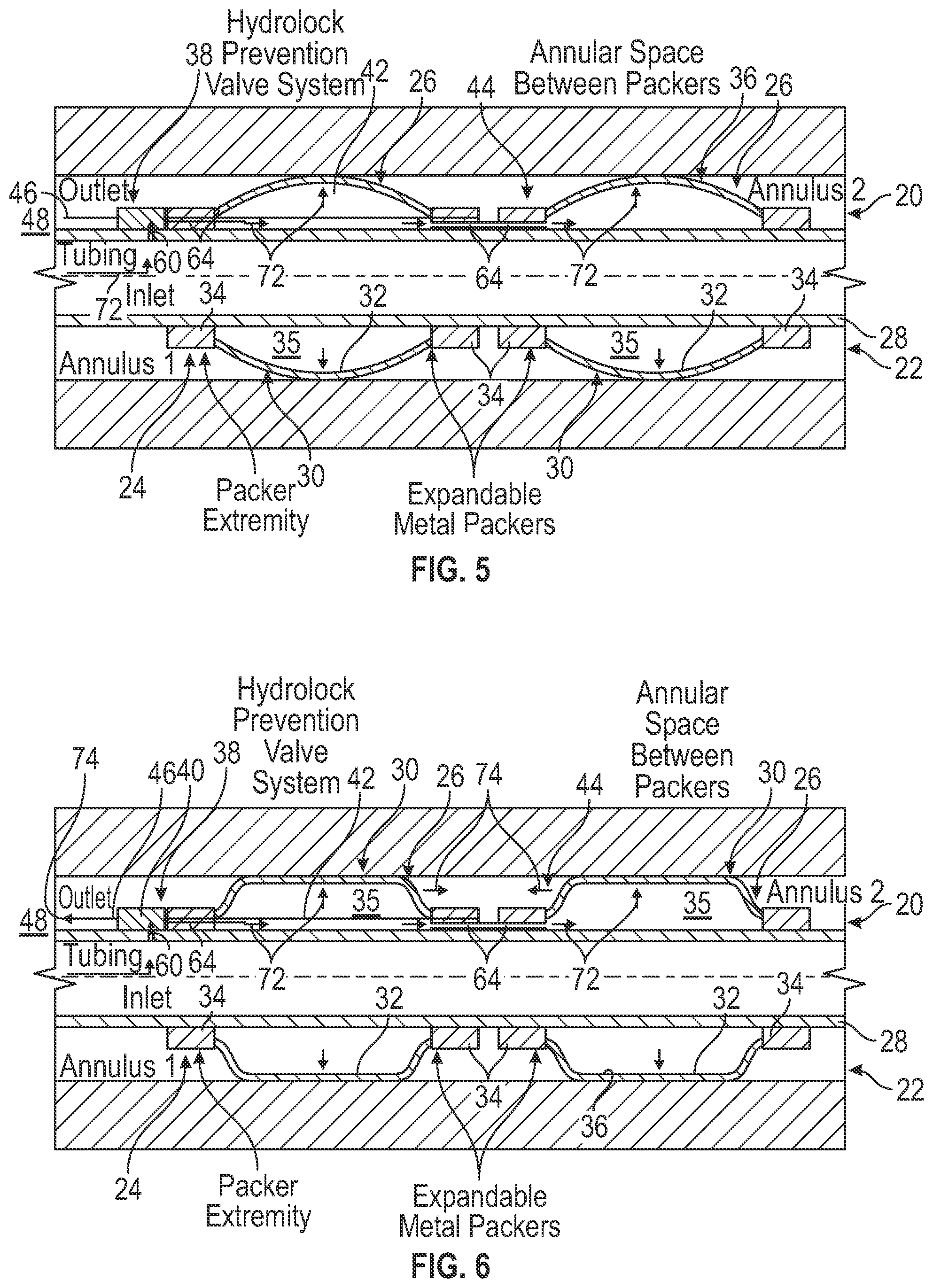 Patent US12410677 Figure 3 – Multiple expandable metal packers with hydrolock prevention