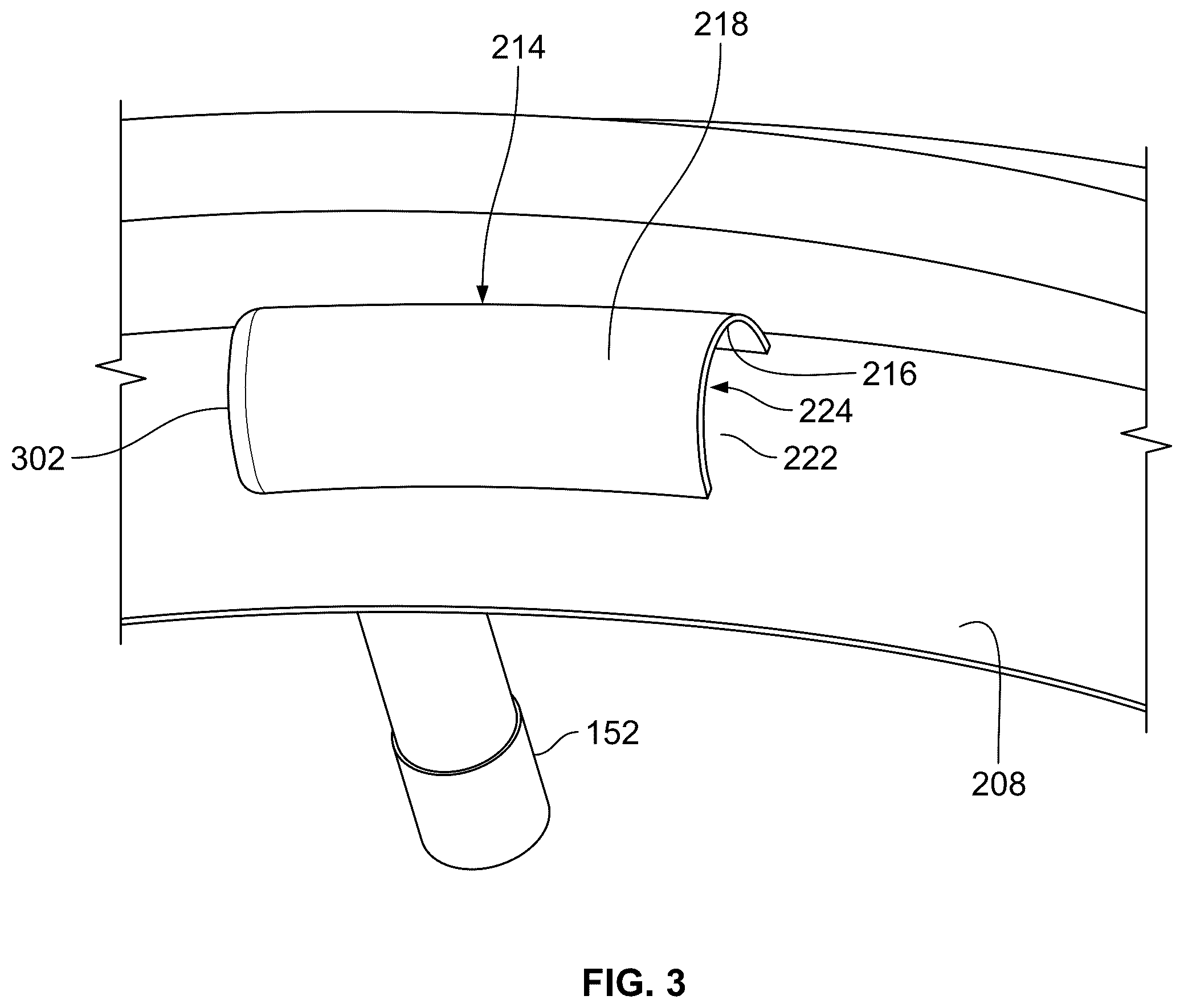 Patent US12410750 Figure 3 – Shielded swirl gas turbine engine inlet anti-icing system