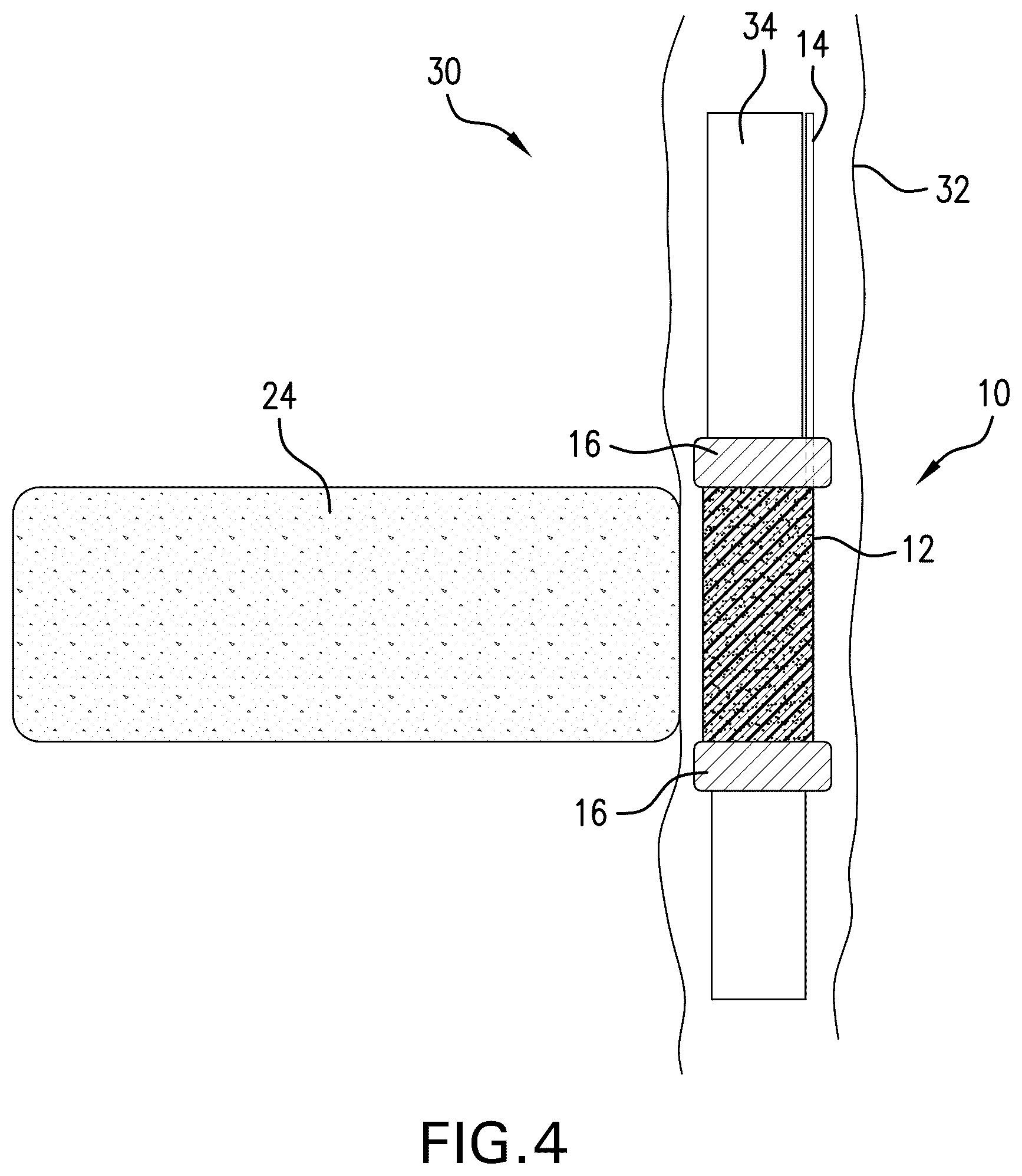 Patent US12410781 Figure 4 – Expandable element configuration, method and system