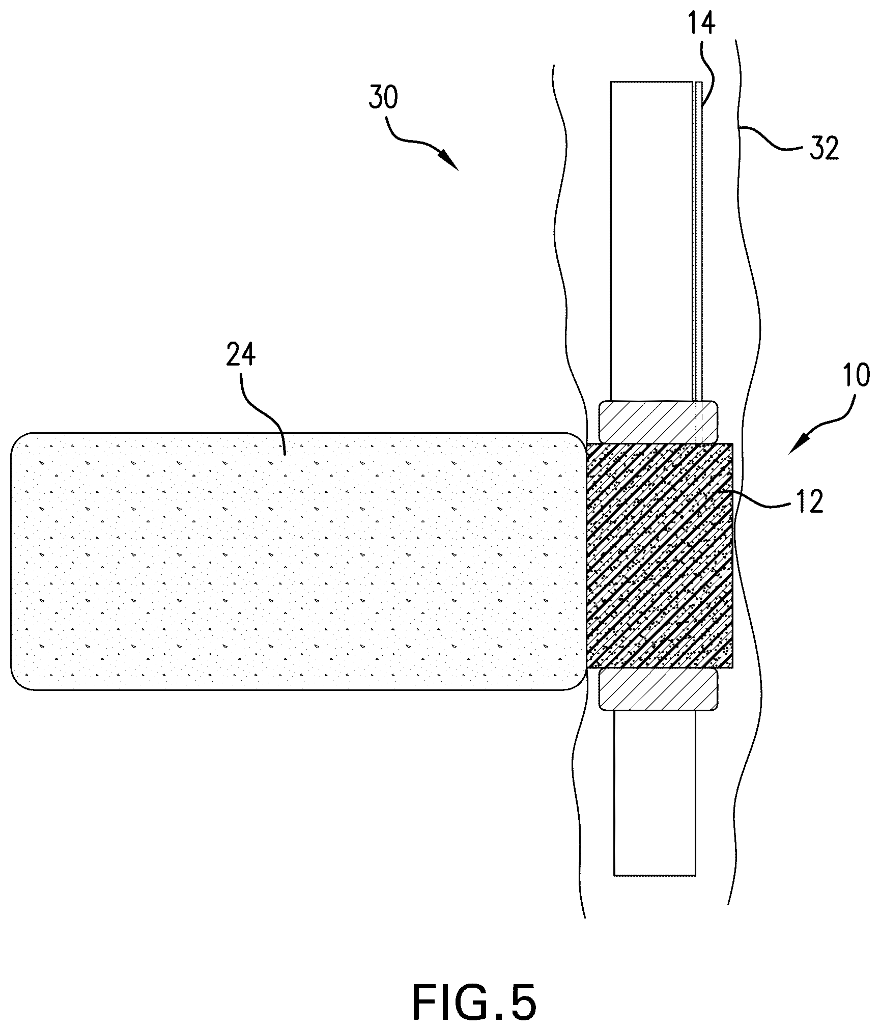 Patent US12410781 Figure 5 – Expandable element configuration, method and system