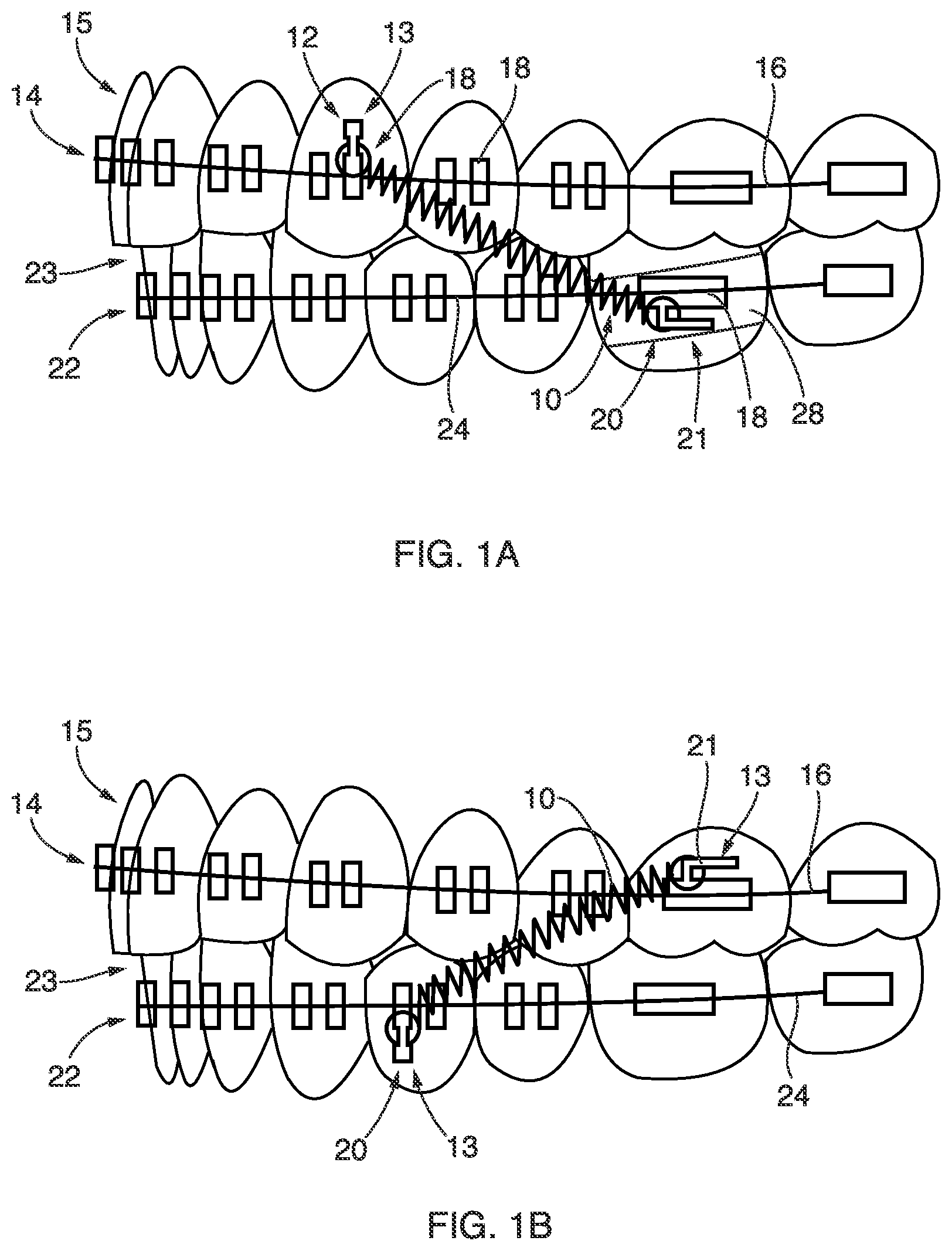 Patent US12410844 Figure 1 – Systems and methods for providing advanced springs
