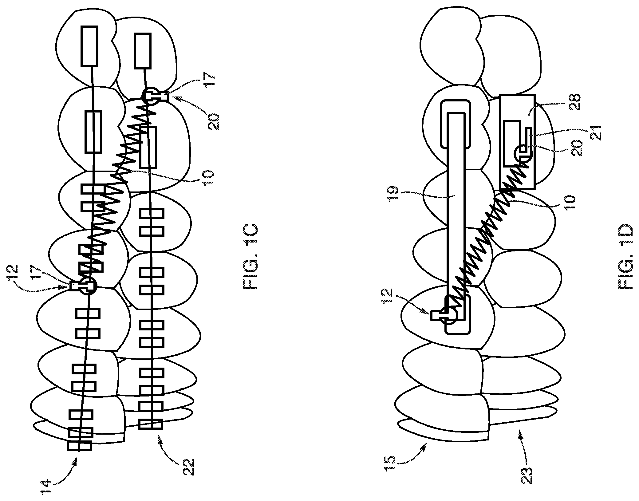 Patent US12410844 Figure 2 – Systems and methods for providing advanced springs