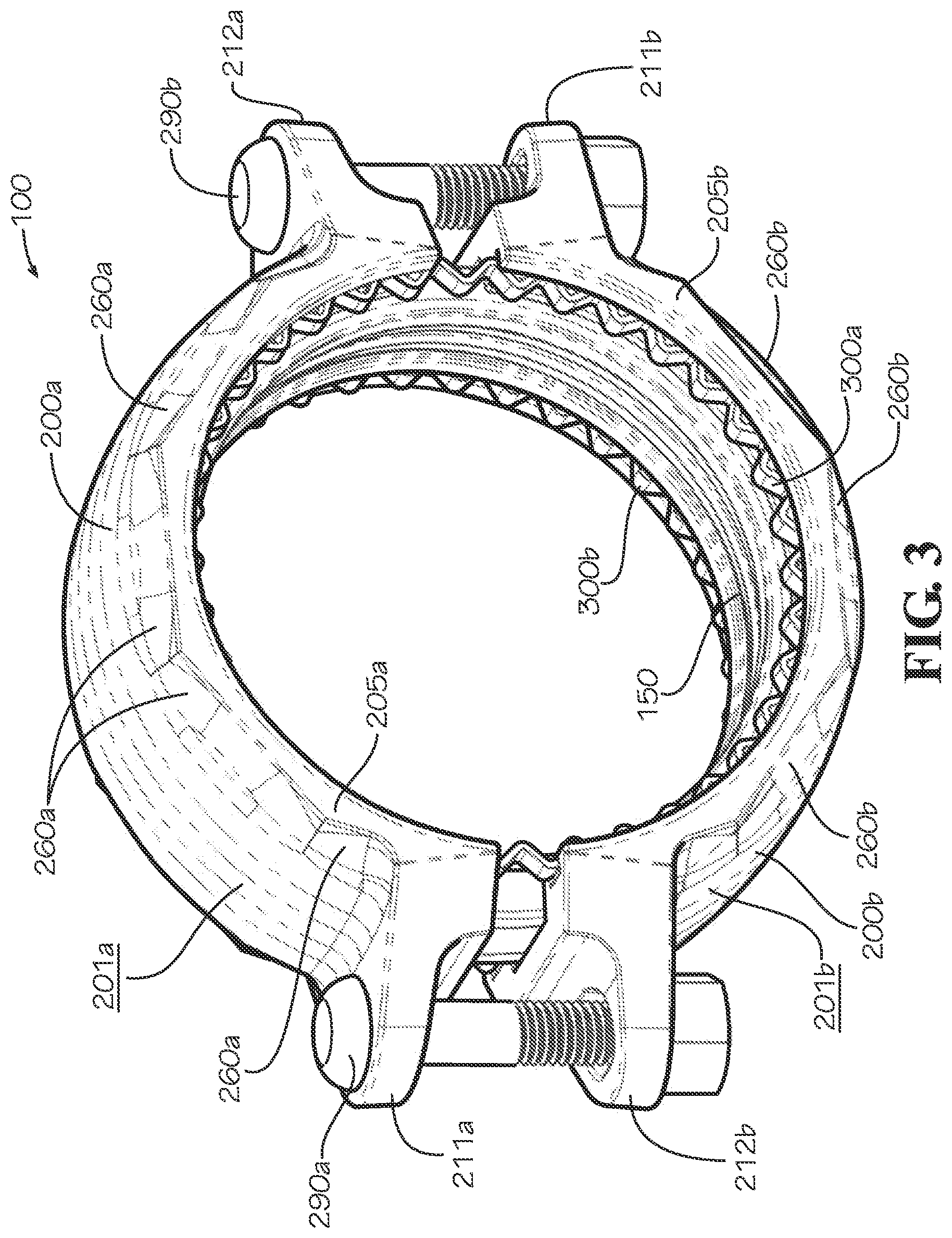 Patent US12410874 Figure 3 – Pipe coupling with pipe connection rings