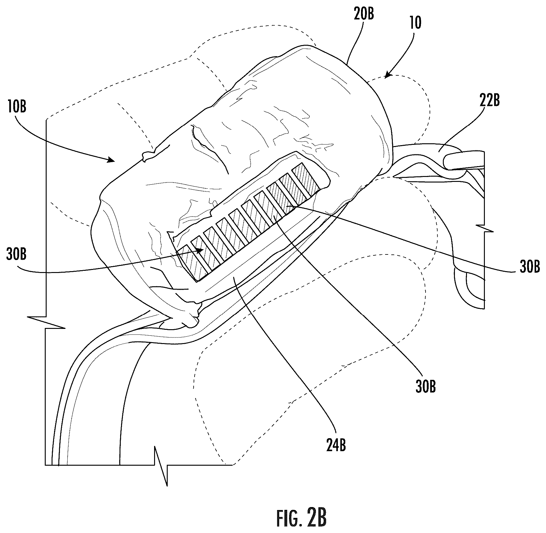 Patent US12410978 Figure 2 – Devices, systems, and computer program products for detecting gunshots and related methods
