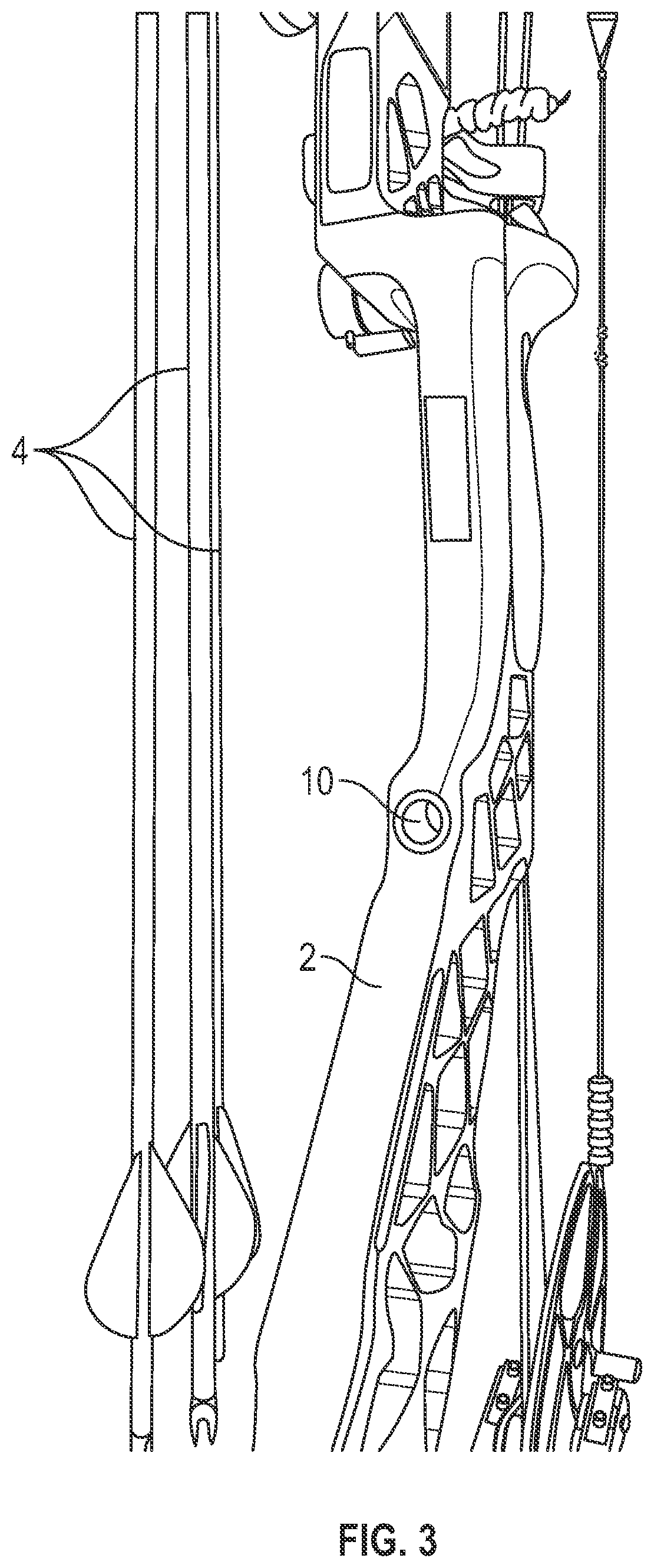 Patent US12410985 Figure 3 – Archery bow monitoring