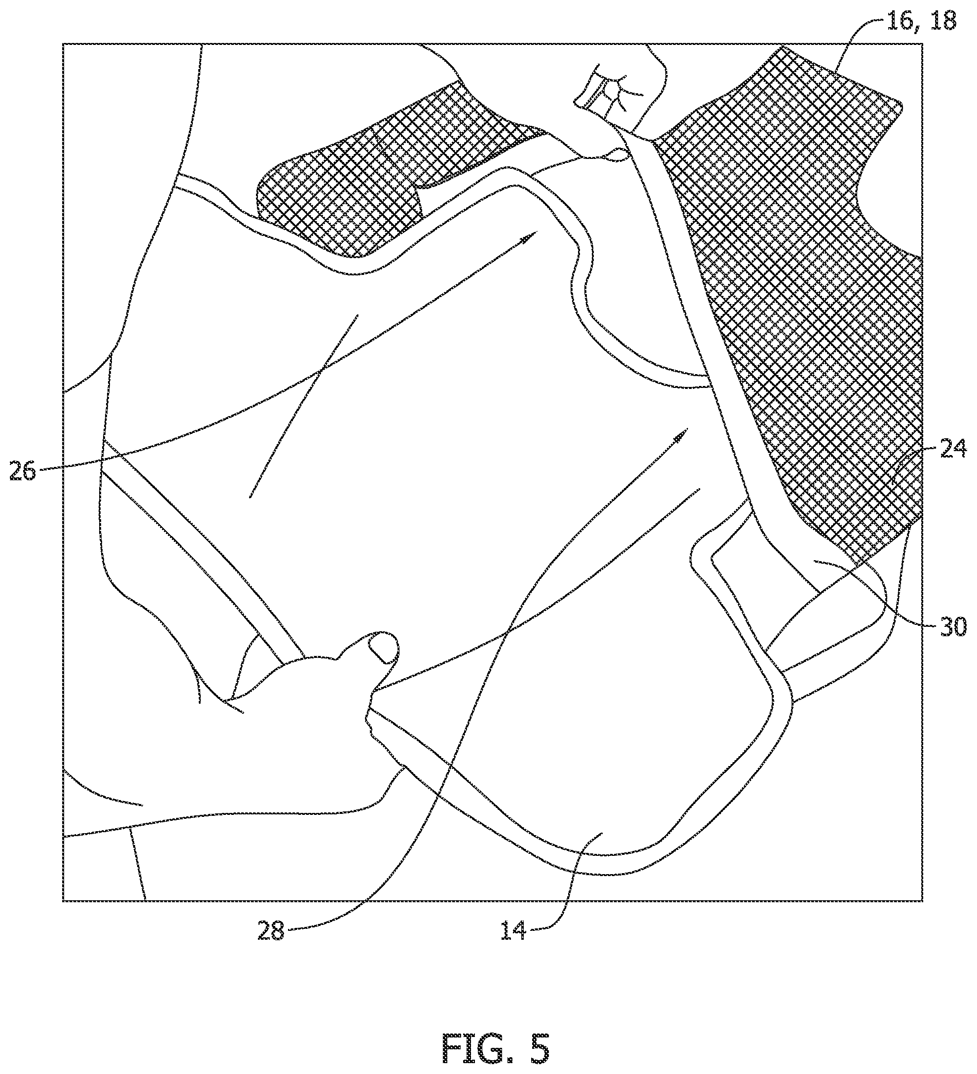Patent US12410992 Figure 5 – Body armor panel for use with personal protective vest and system for assembling same