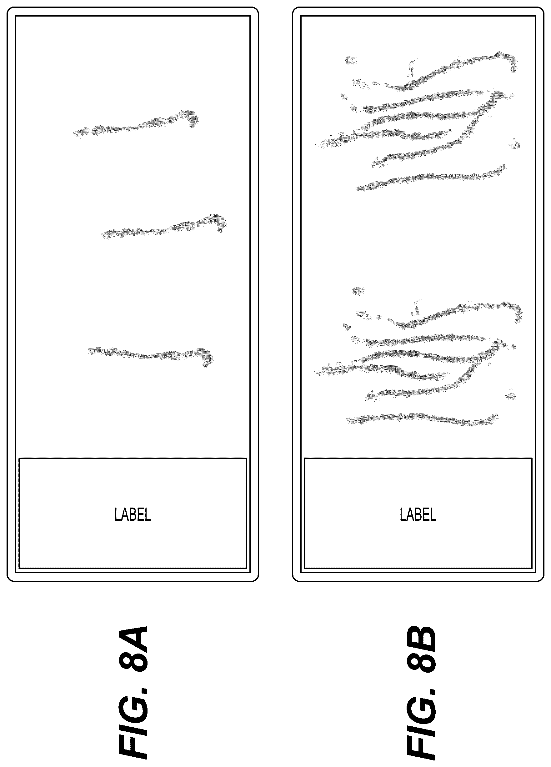 Patent US12417530 Figure 11 – Systems and methods to process electronic images to provide localized semantic analysis of whole slide images