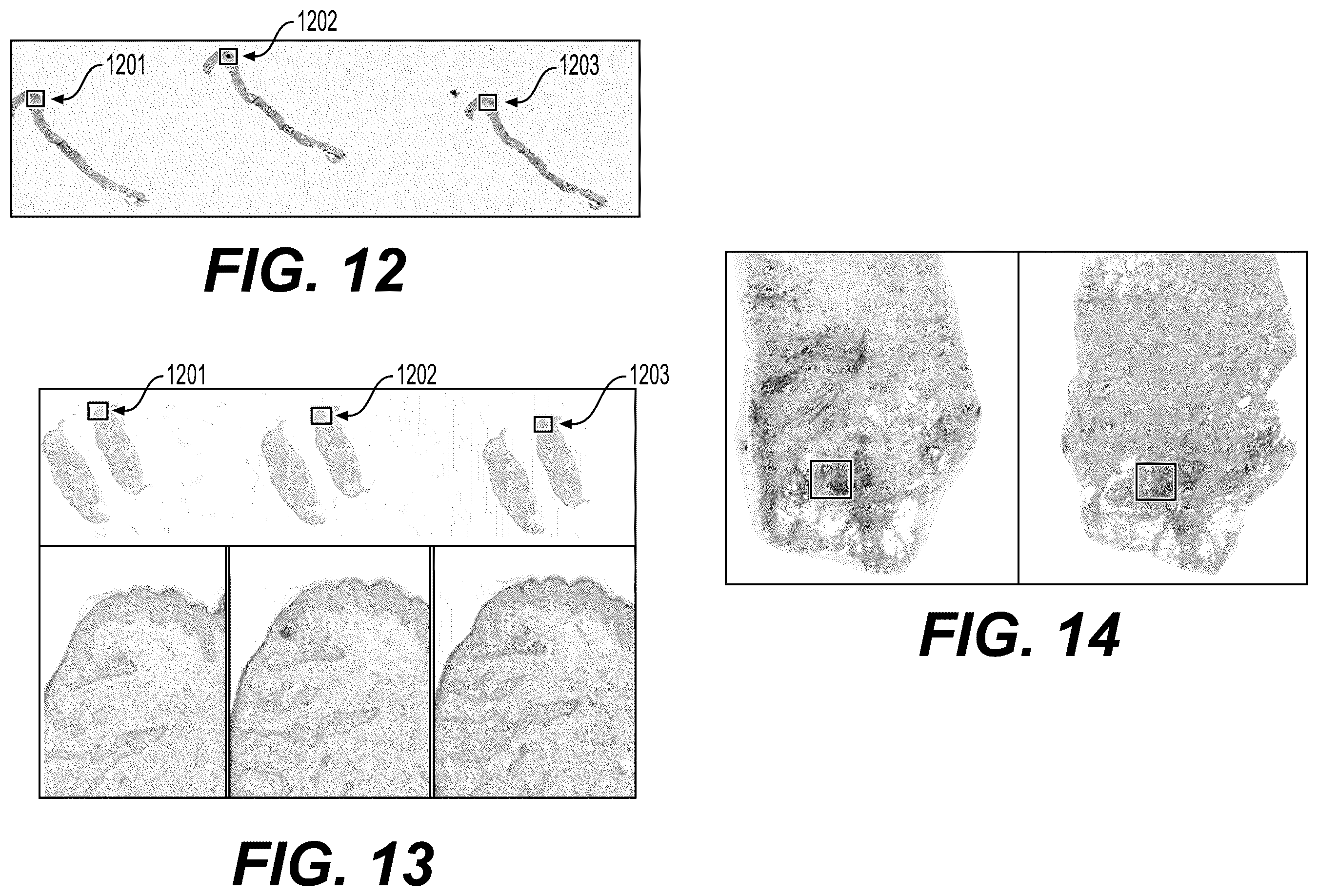 Patent US12417530 Figure 13 – Systems and methods to process electronic images to provide localized semantic analysis of whole slide images