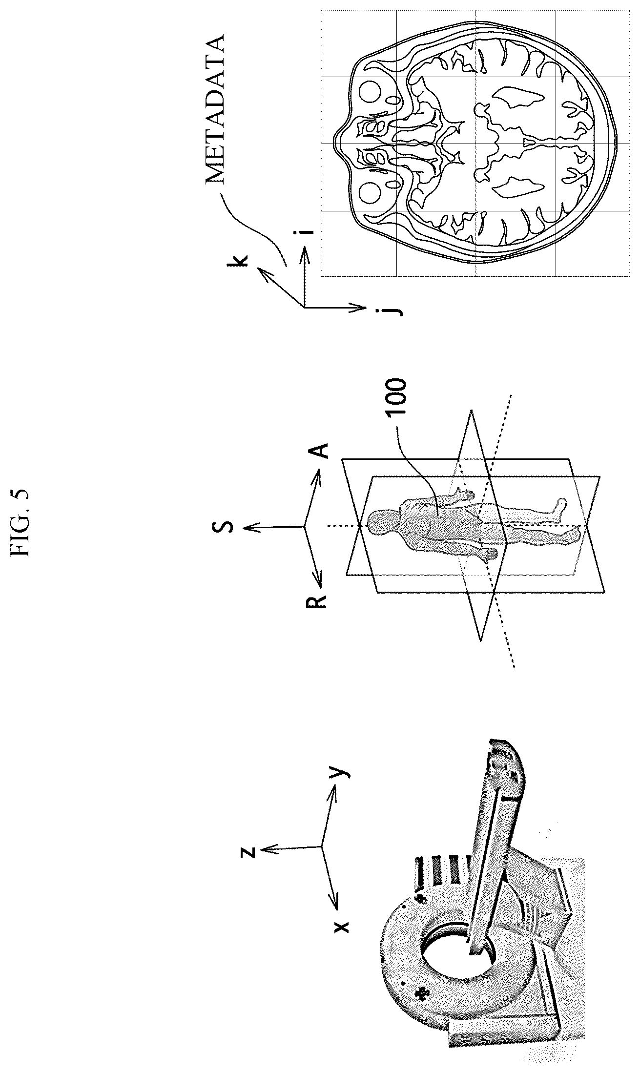 Patent US12417534 Figure 5 – Medical image analysis method, medical image analysis device, and medical image analysis system