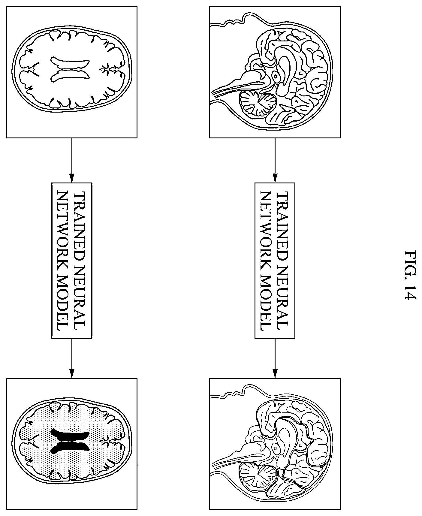 Patent US12417534 Figure 14 – Medical image analysis method, medical image analysis device, and medical image analysis system