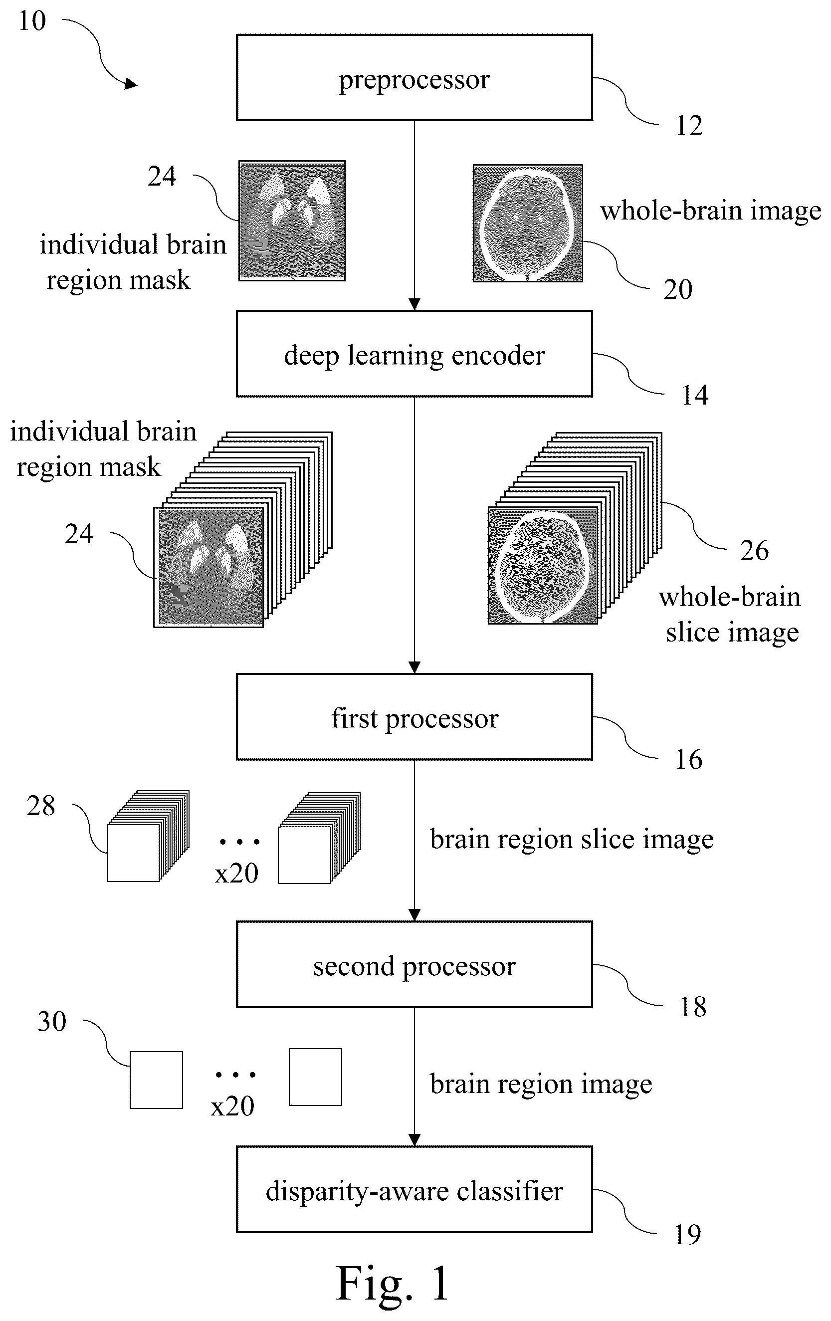 Patent US12417536 Figure 1 – Automated detection system for acute ischemic stroke