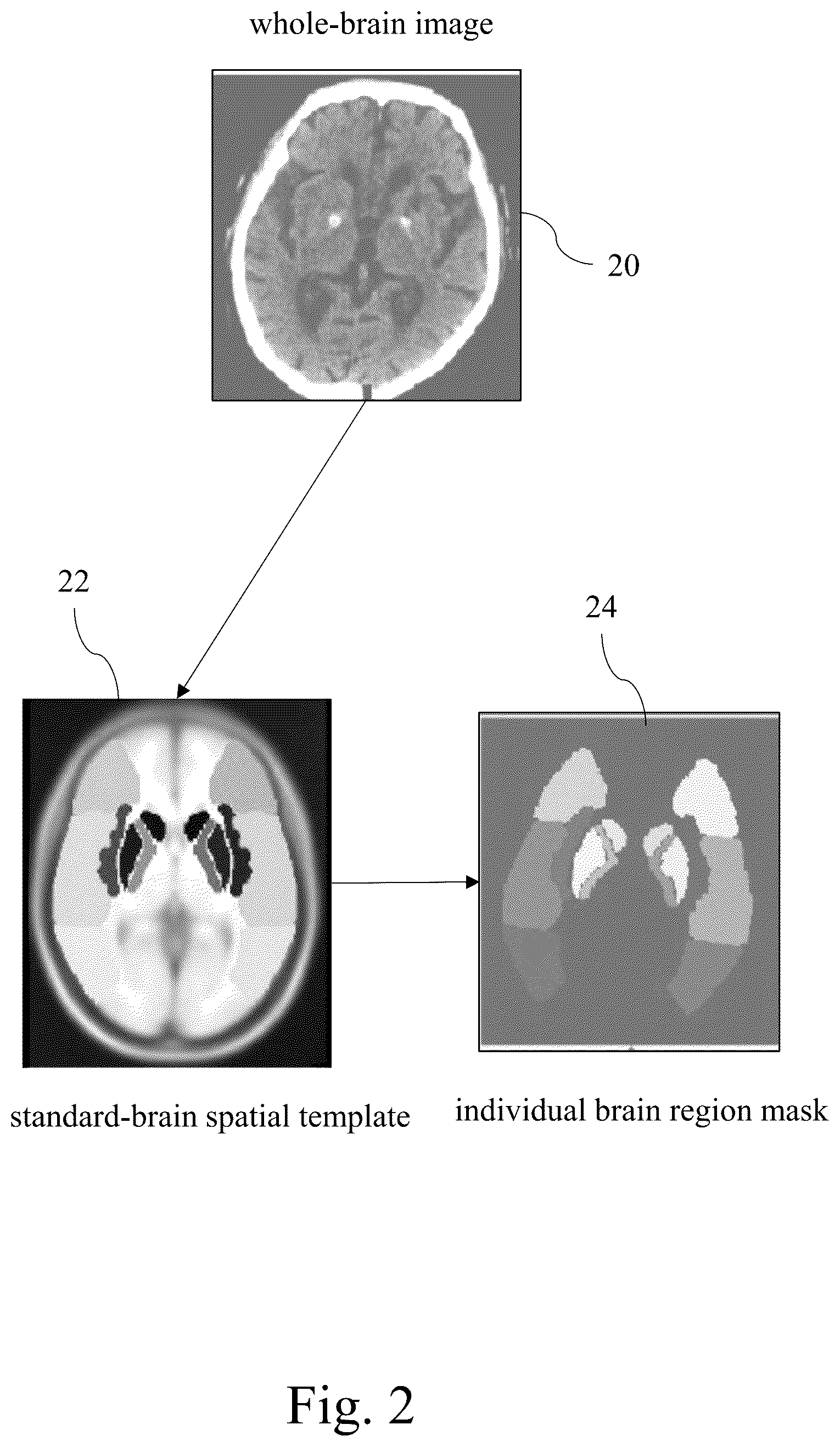 Patent US12417536 Figure 2 – Automated detection system for acute ischemic stroke