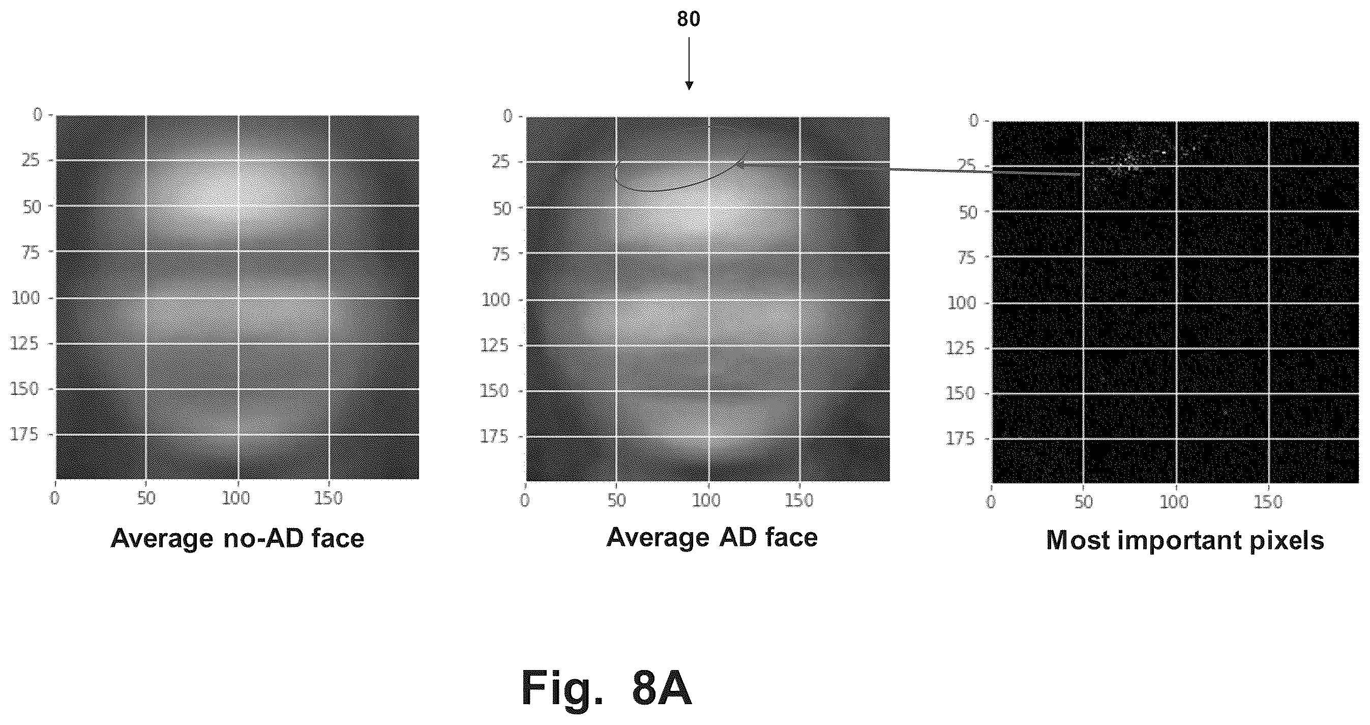 Patent US12417539 Figure 8 – Method and system for estimating early progression of dementia from human head images