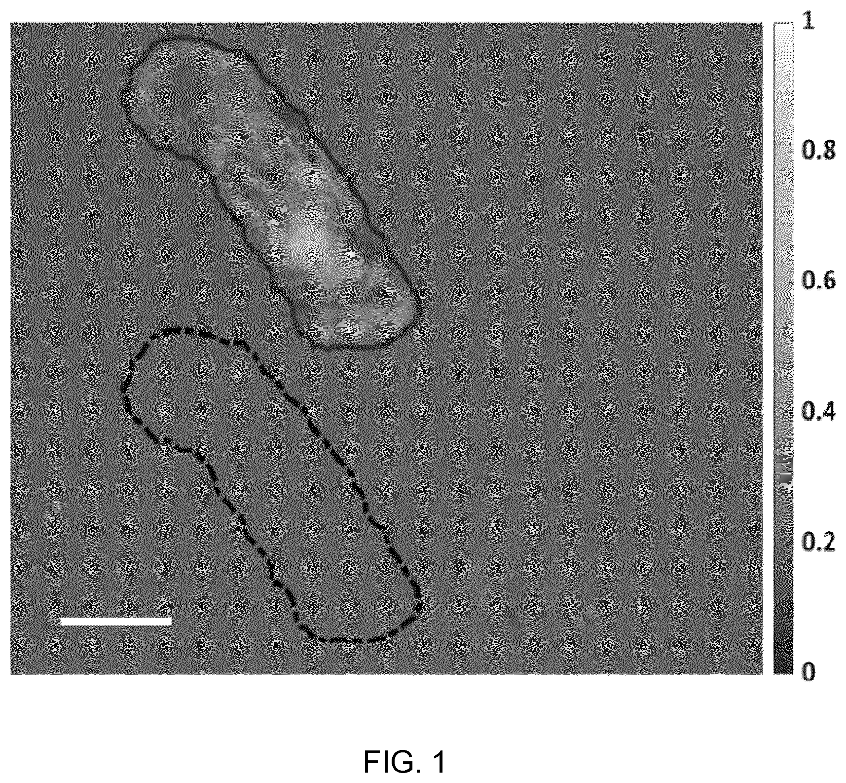 Patent US12417540 Figure 1 – Methods and apparatus for imaging, analysing images and classifying presumed protein deposits in the retina