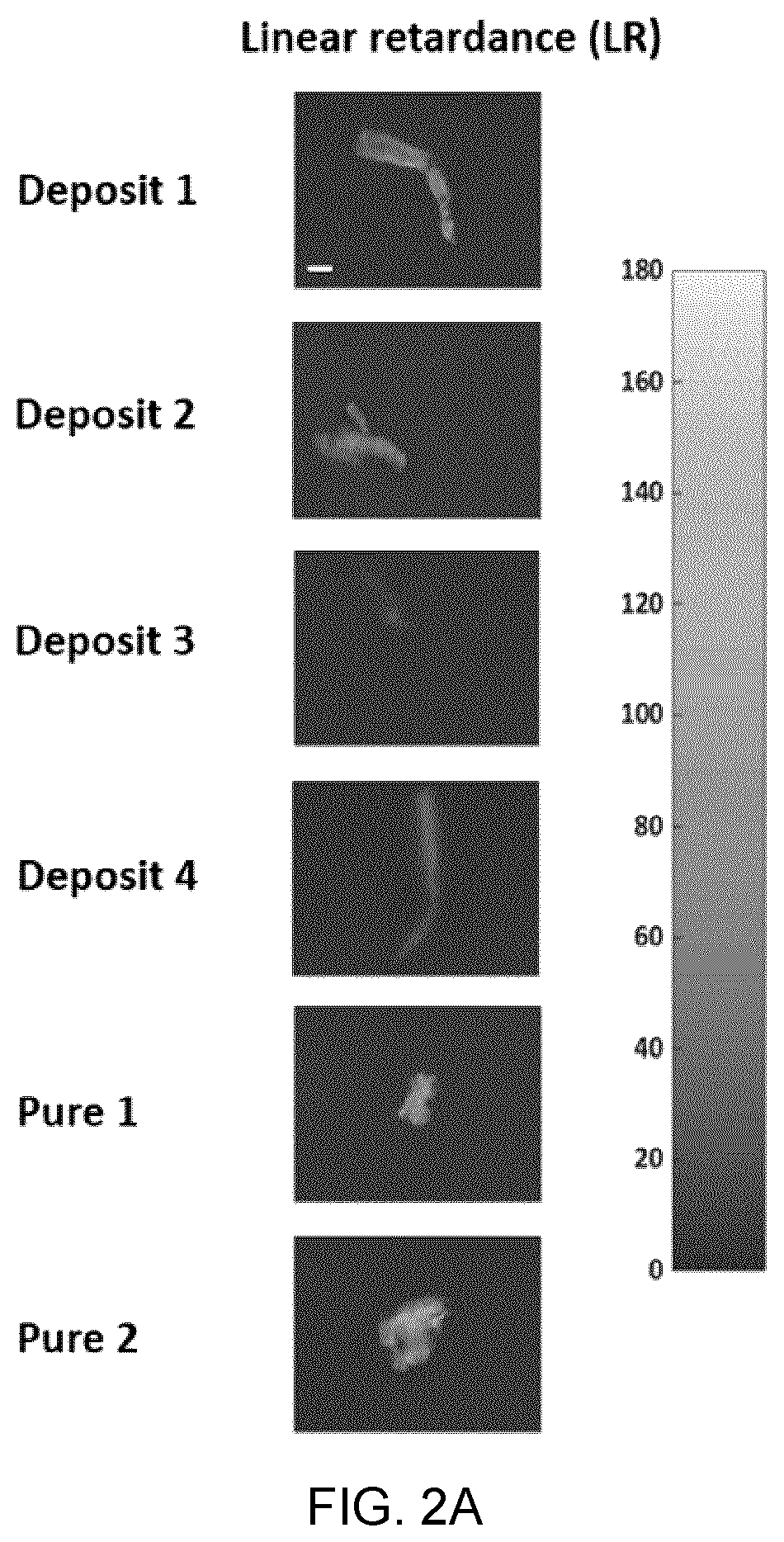 Patent US12417540 Figure 2 – Methods and apparatus for imaging, analysing images and classifying presumed protein deposits in the retina