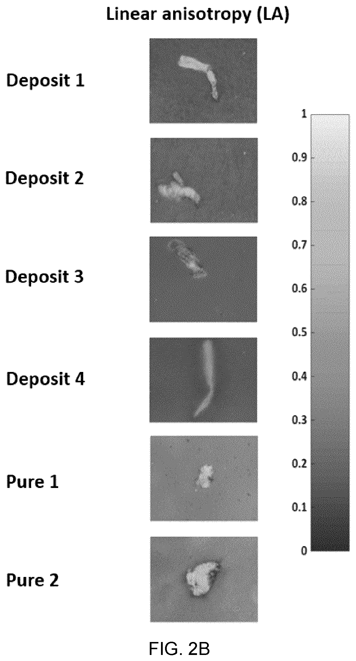 Patent US12417540 Figure 3 – Methods and apparatus for imaging, analysing images and classifying presumed protein deposits in the retina