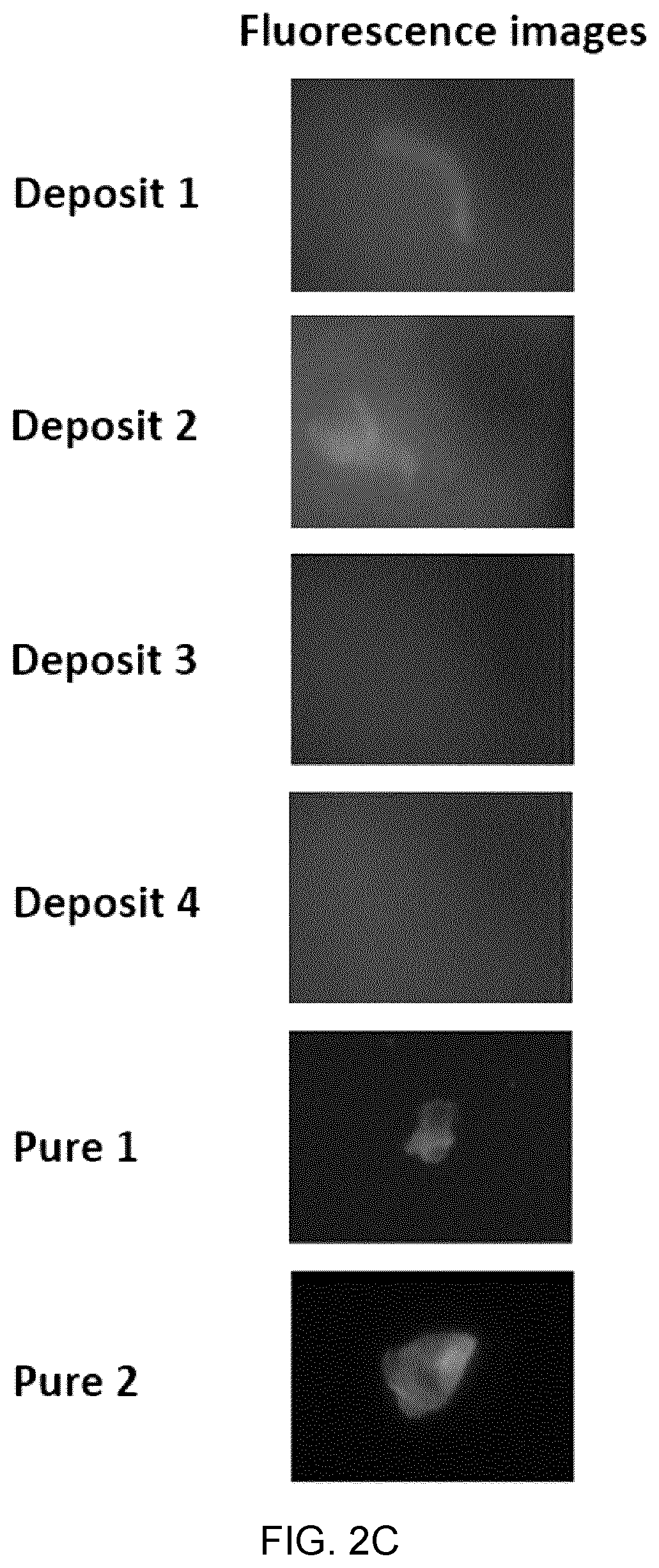 Patent US12417540 Figure 4 – Methods and apparatus for imaging, analysing images and classifying presumed protein deposits in the retina