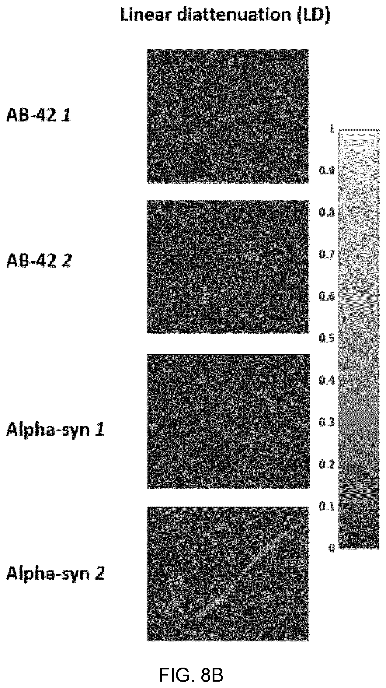 Patent US12417540 Figure 15 – Methods and apparatus for imaging, analysing images and classifying presumed protein deposits in the retina