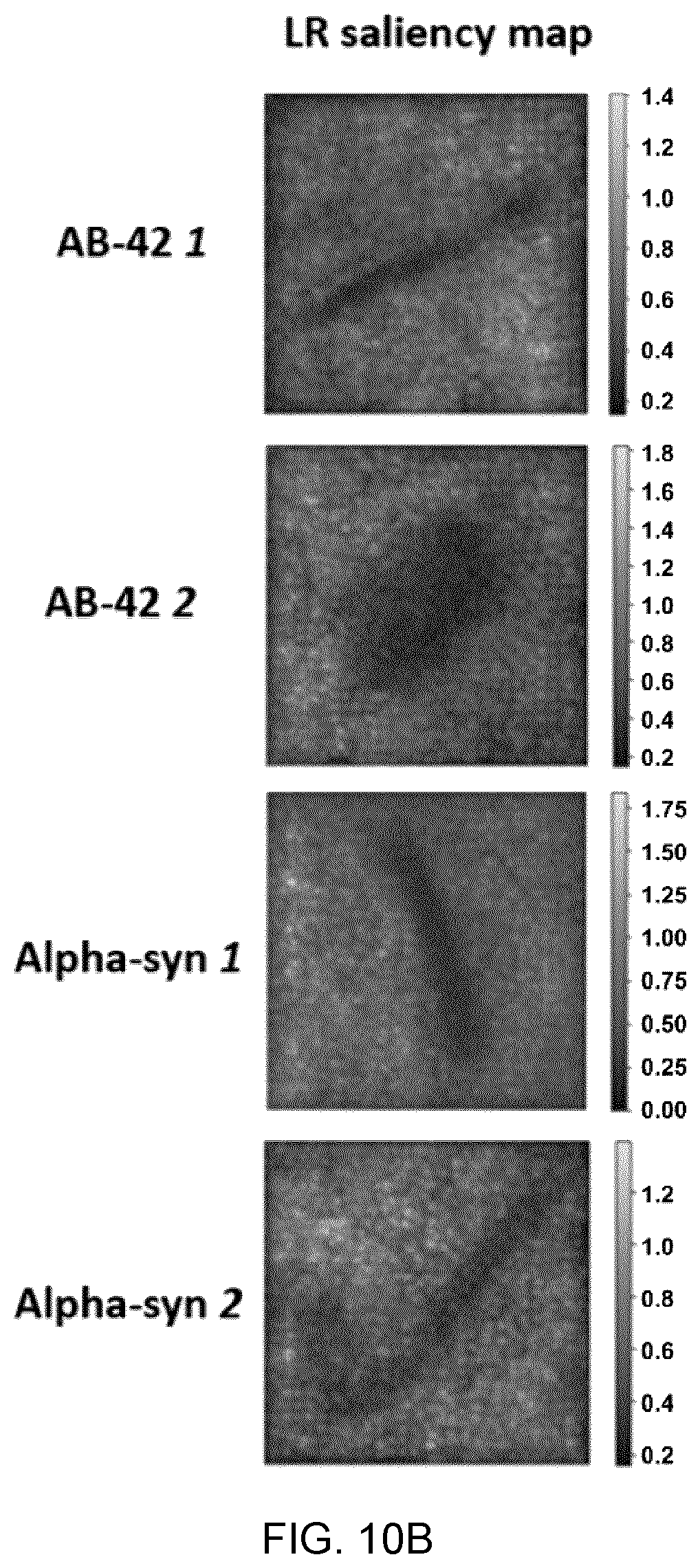 Patent US12417540 Figure 20 – Methods and apparatus for imaging, analysing images and classifying presumed protein deposits in the retina