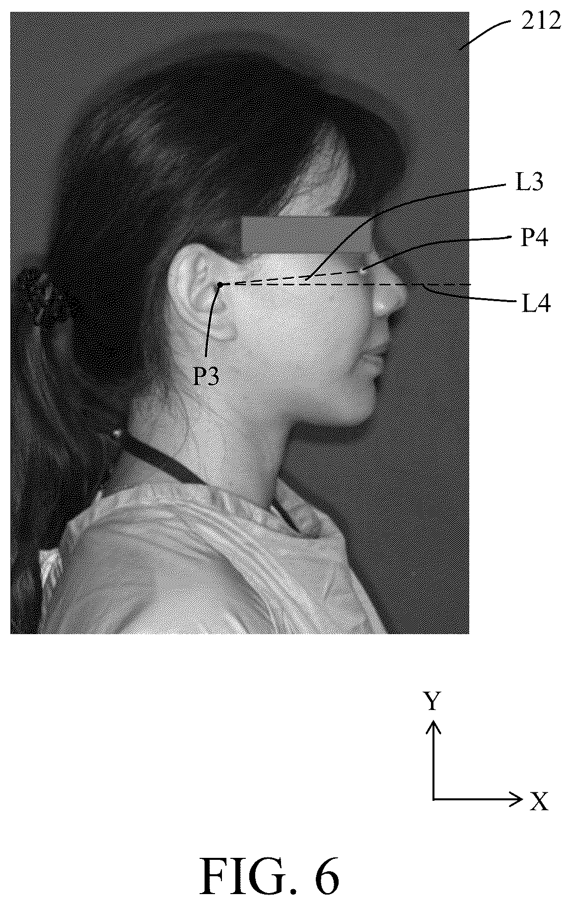 Patent US12417609 Figure 6 – Method, system and computer-readable storage medium for categorizing and adjusting orientation of clinical image