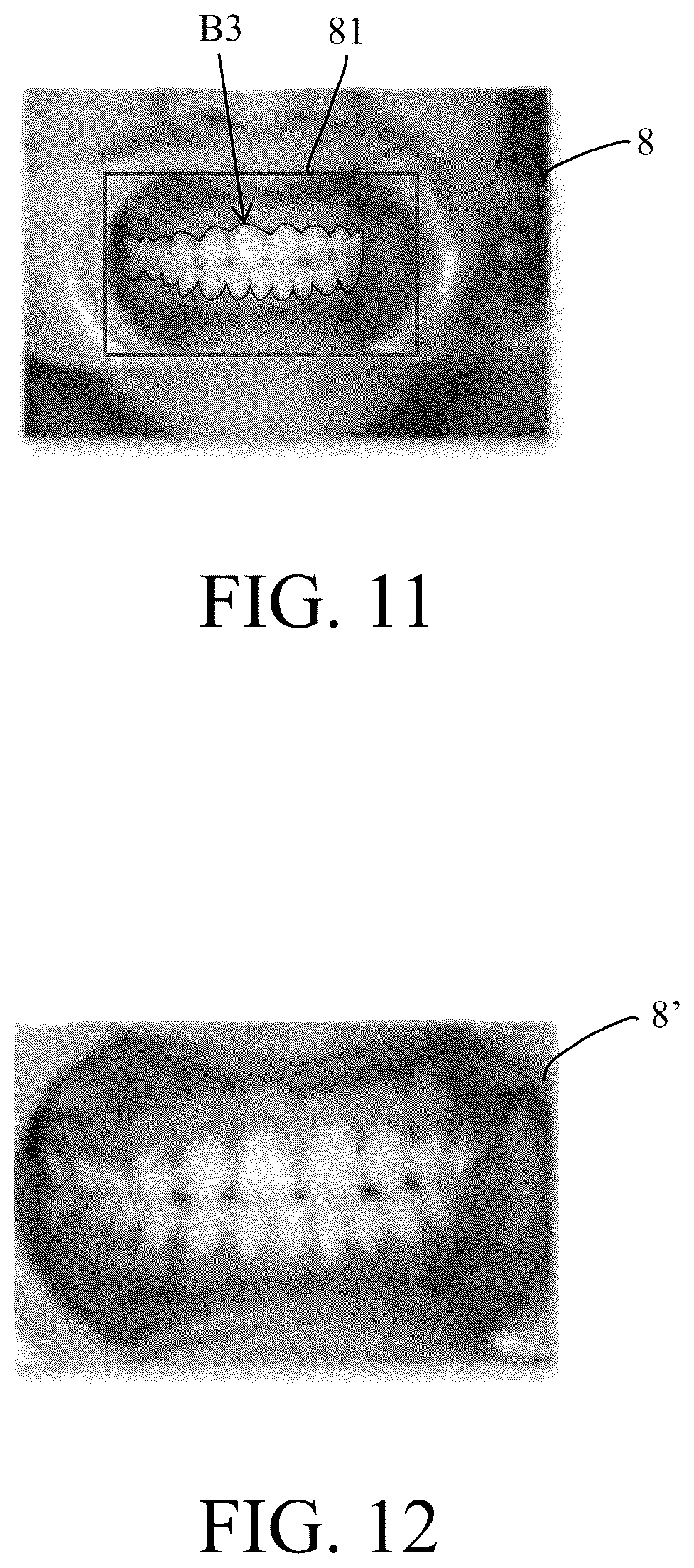 Patent US12417609 Figure 9 – Method, system and computer-readable storage medium for categorizing and adjusting orientation of clinical image