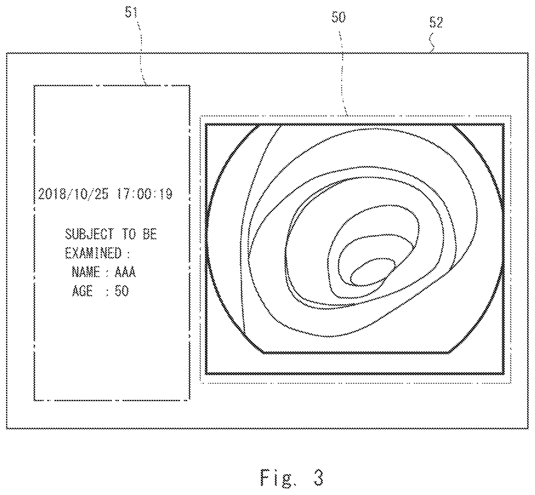 Patent US12417626 Figure 3 – Information processing device, display method, and non-transitory computer-readable medium for supporting medical decision making