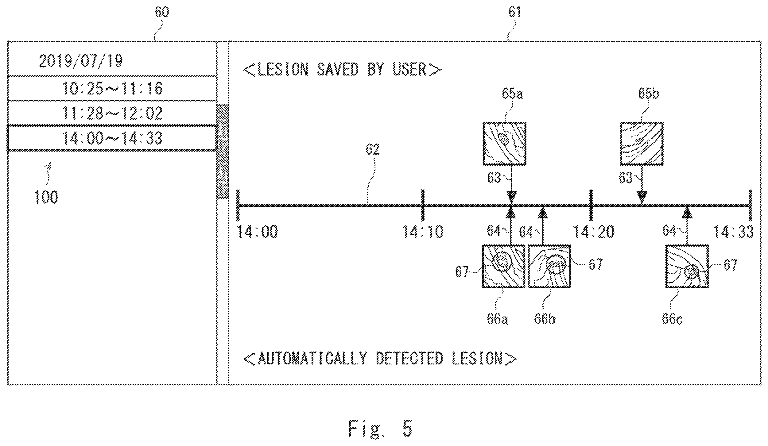 Patent US12417626 Figure 5 – Information processing device, display method, and non-transitory computer-readable medium for supporting medical decision making