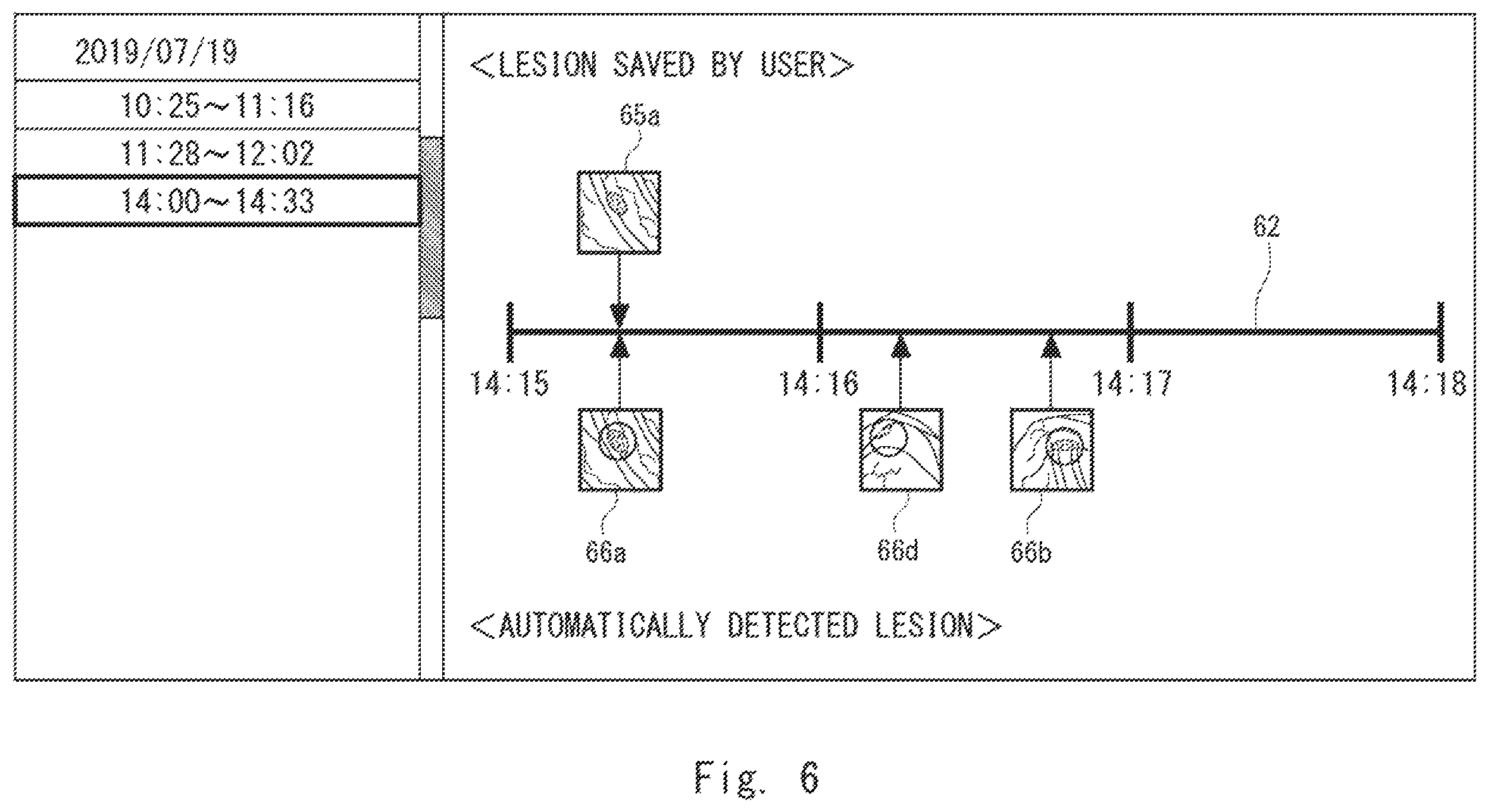 Patent US12417626 Figure 6 – Information processing device, display method, and non-transitory computer-readable medium for supporting medical decision making