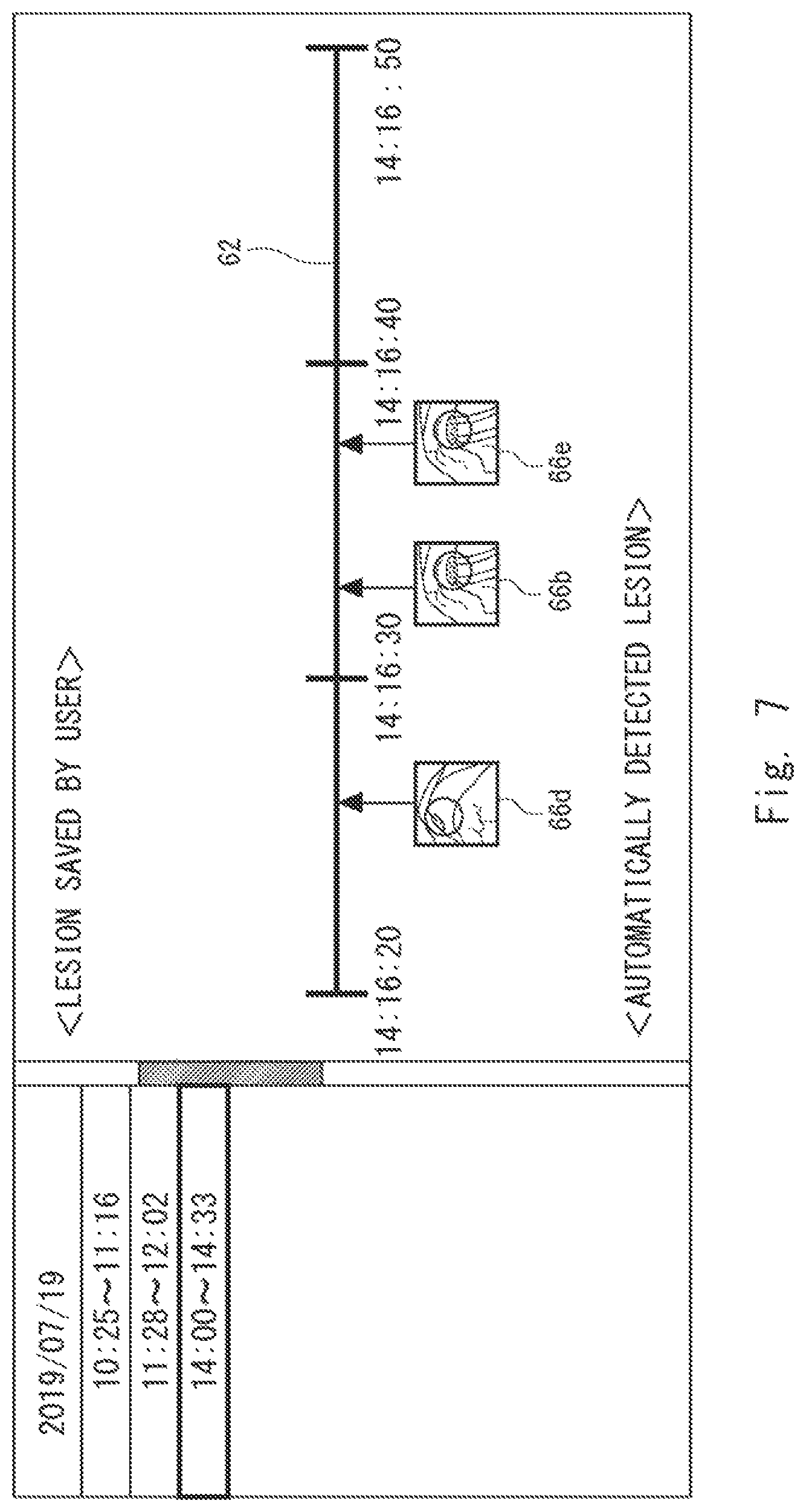 Patent US12417626 Figure 7 – Information processing device, display method, and non-transitory computer-readable medium for supporting medical decision making