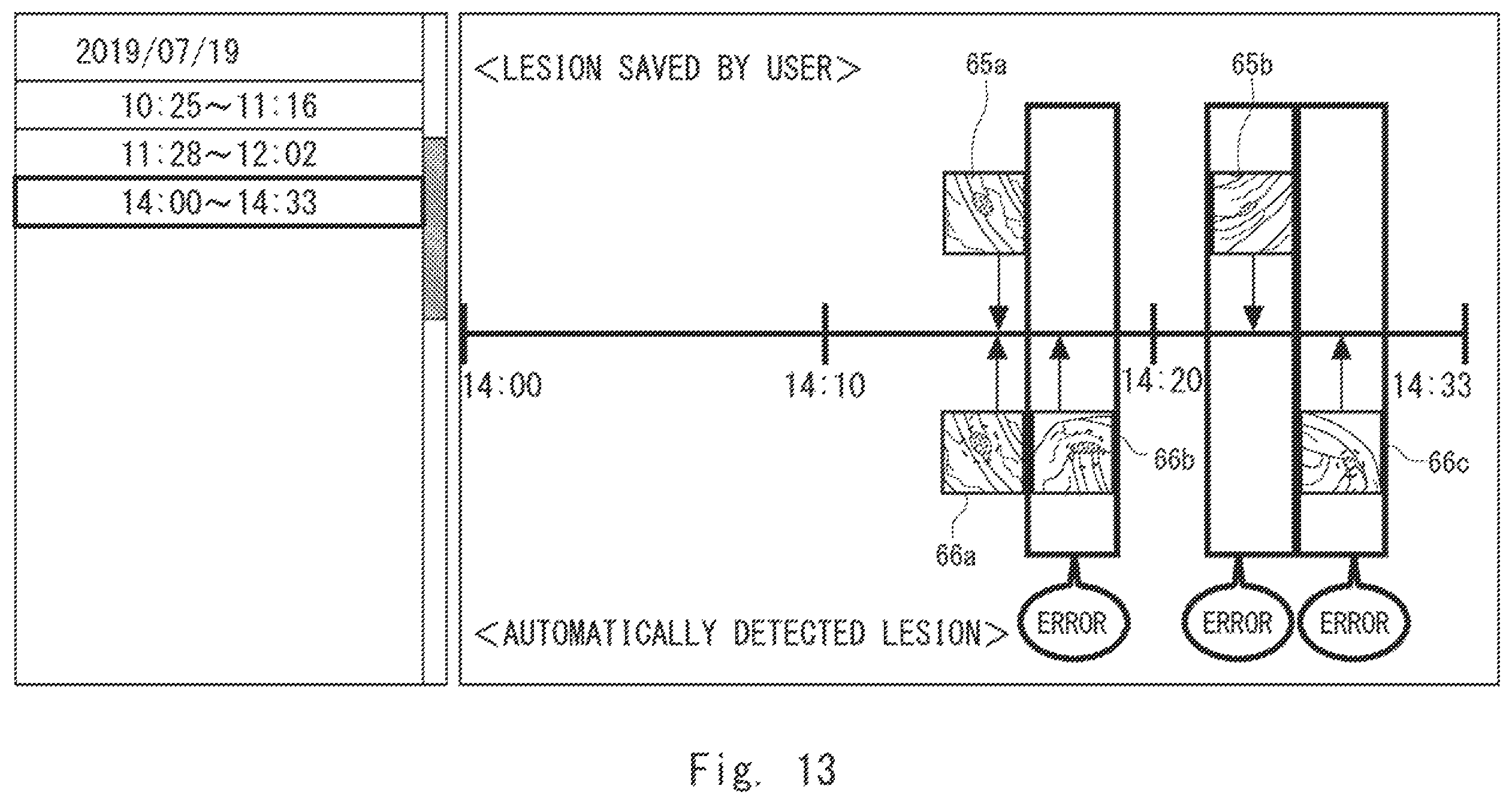 Patent US12417626 Figure 13 – Information processing device, display method, and non-transitory computer-readable medium for supporting medical decision making