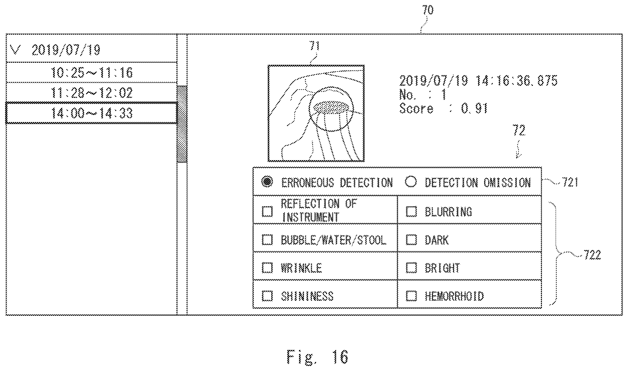 Patent US12417626 Figure 16 – Information processing device, display method, and non-transitory computer-readable medium for supporting medical decision making
