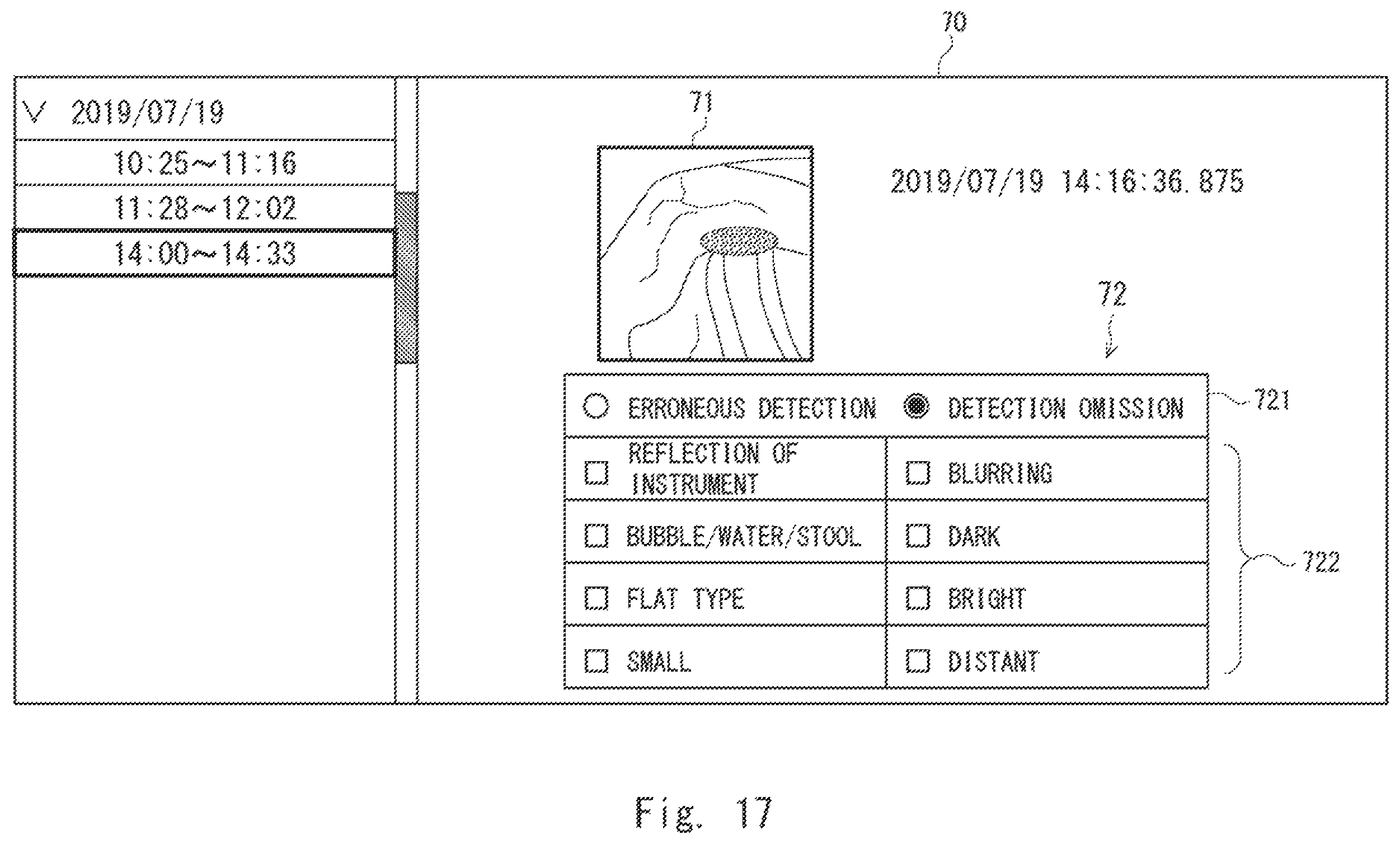 Patent US12417626 Figure 17 – Information processing device, display method, and non-transitory computer-readable medium for supporting medical decision making