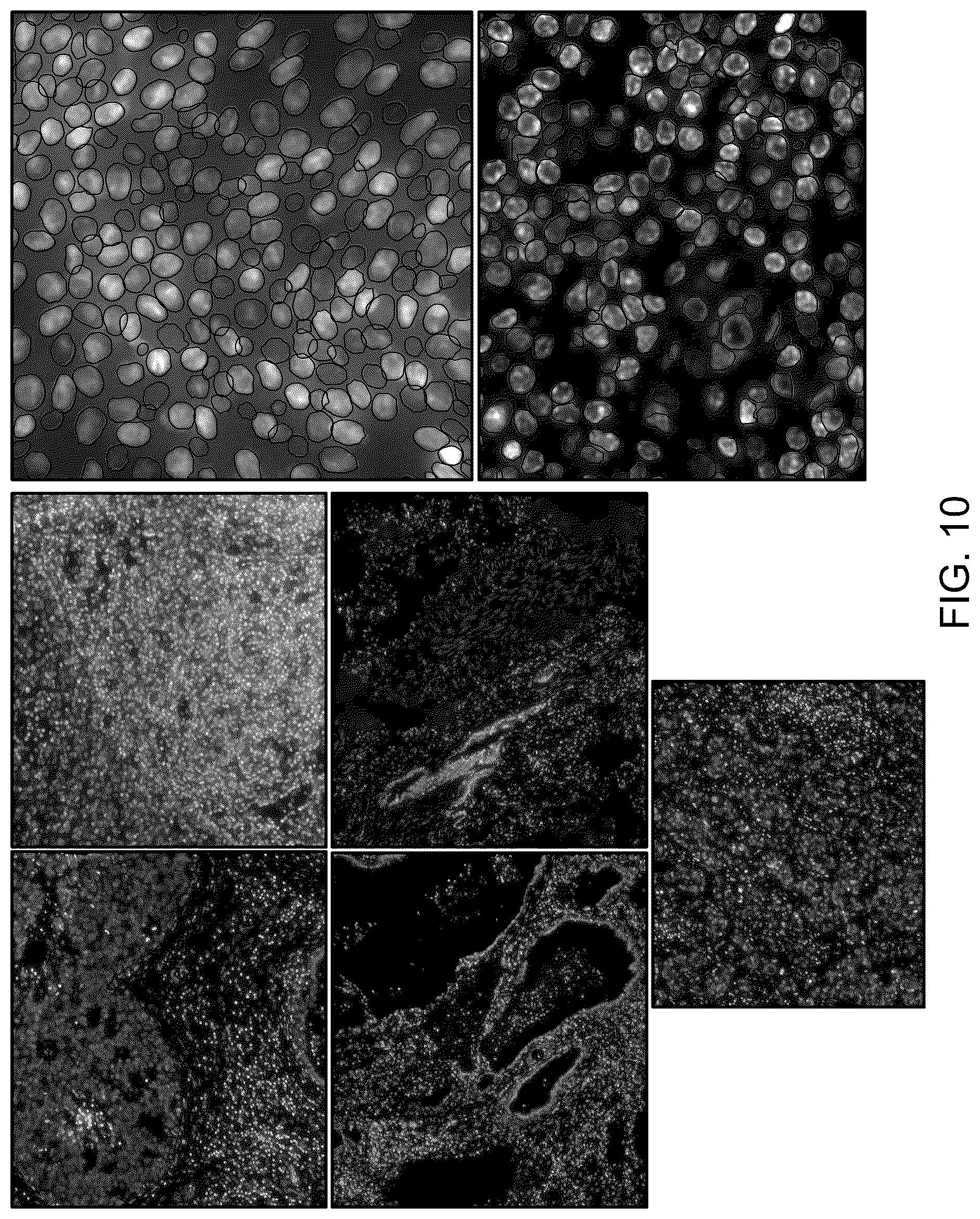 Patent US12417646 Figure 13 – Systems and methods for image segmentation