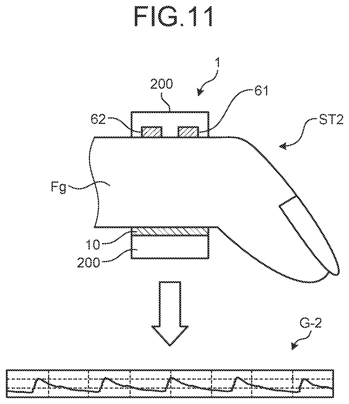 Patent US12417653 Figure 10 – Detection device