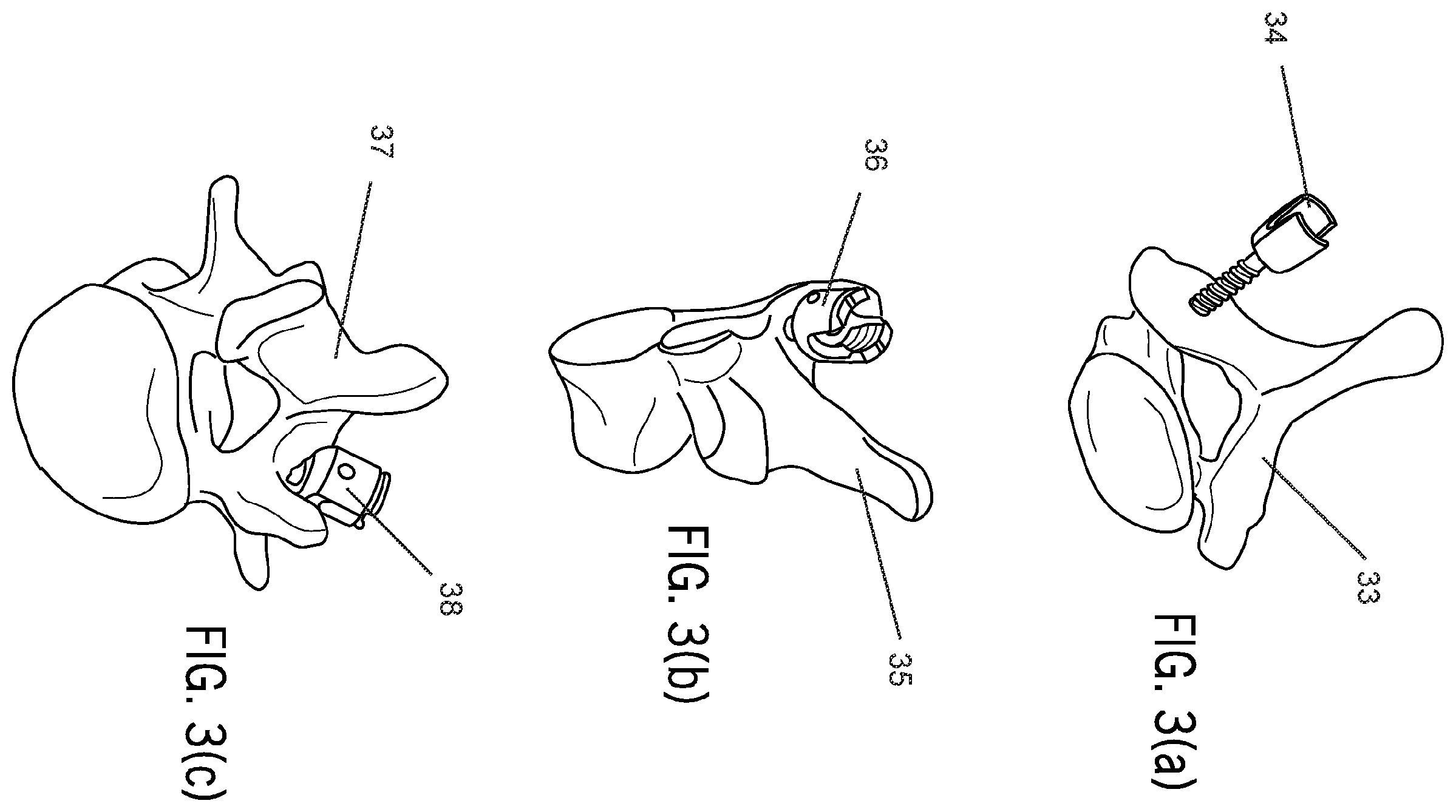 Patent US12417716 Figure 3 – Systems and methods for surgical training model