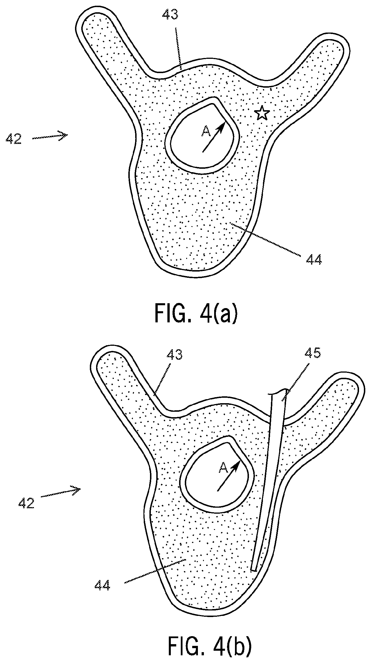 Patent US12417716 Figure 4 – Systems and methods for surgical training model