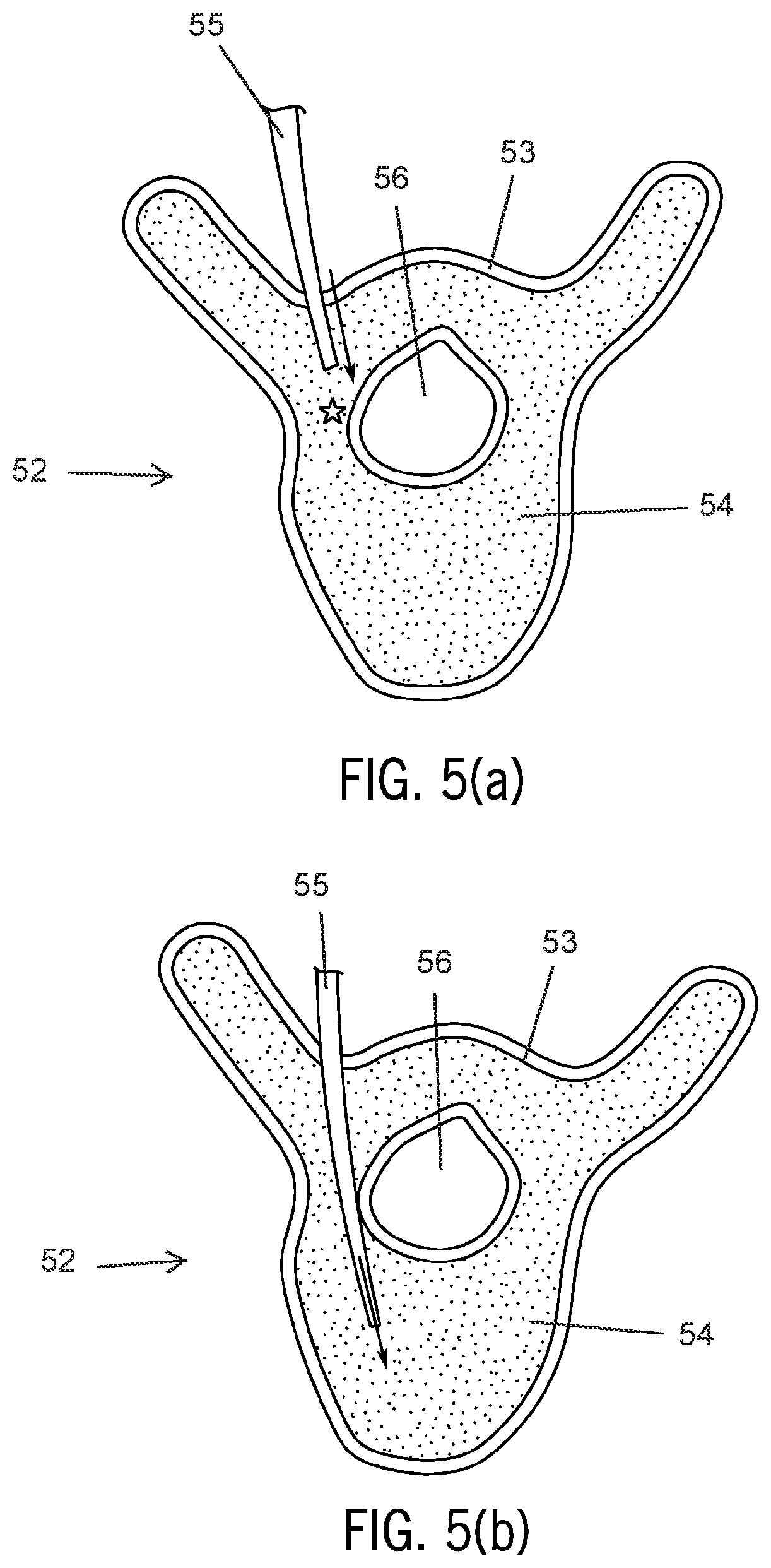 Patent US12417716 Figure 5 – Systems and methods for surgical training model