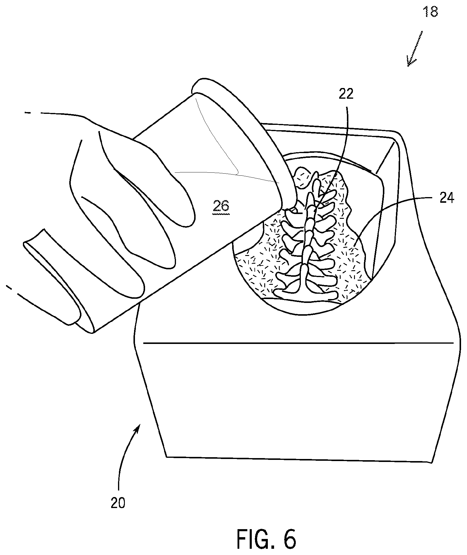 Patent US12417716 Figure 6 – Systems and methods for surgical training model