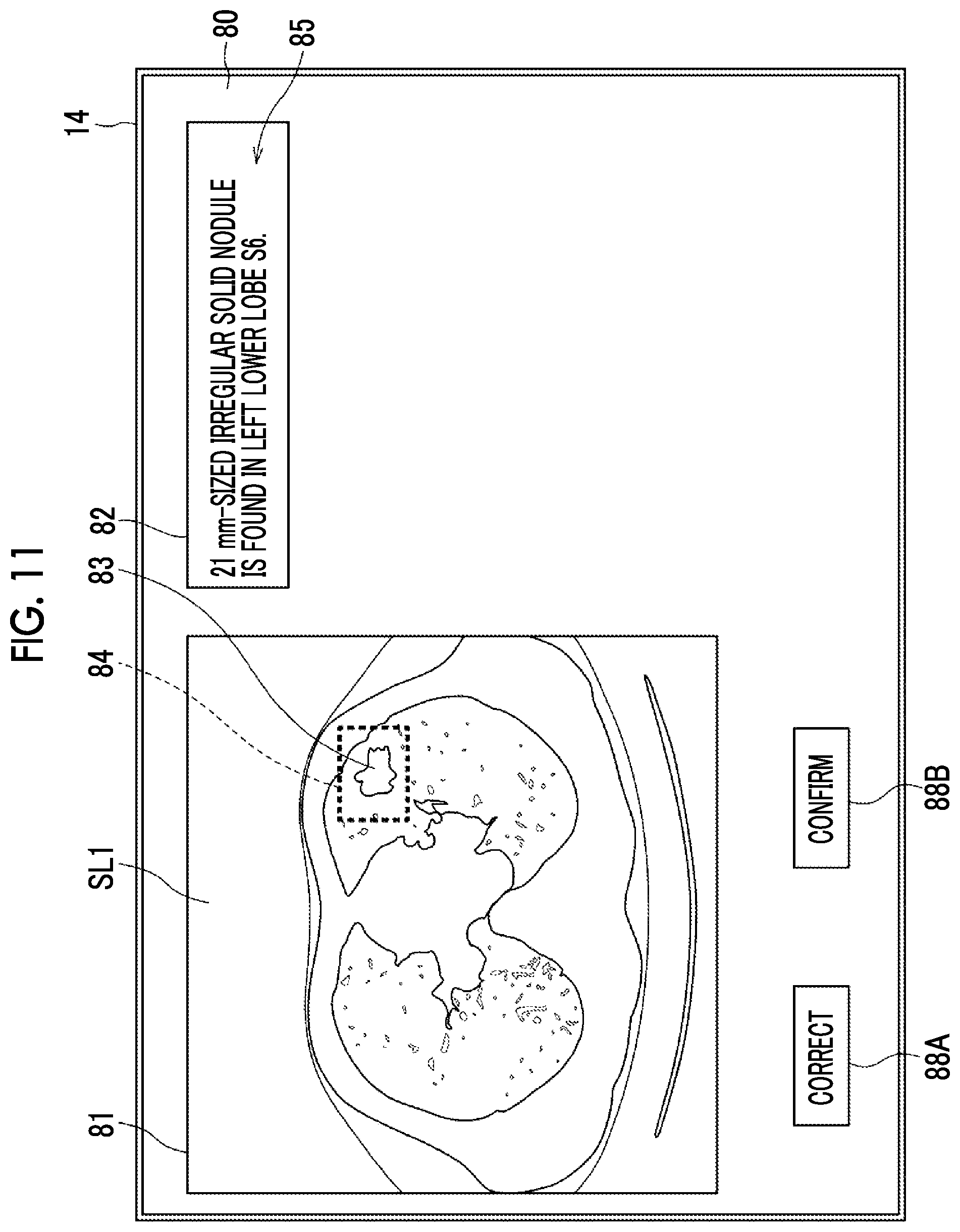 Patent US12417838 Figure 9 – Document creation support apparatus, method, and program to generate medical document based on medical images