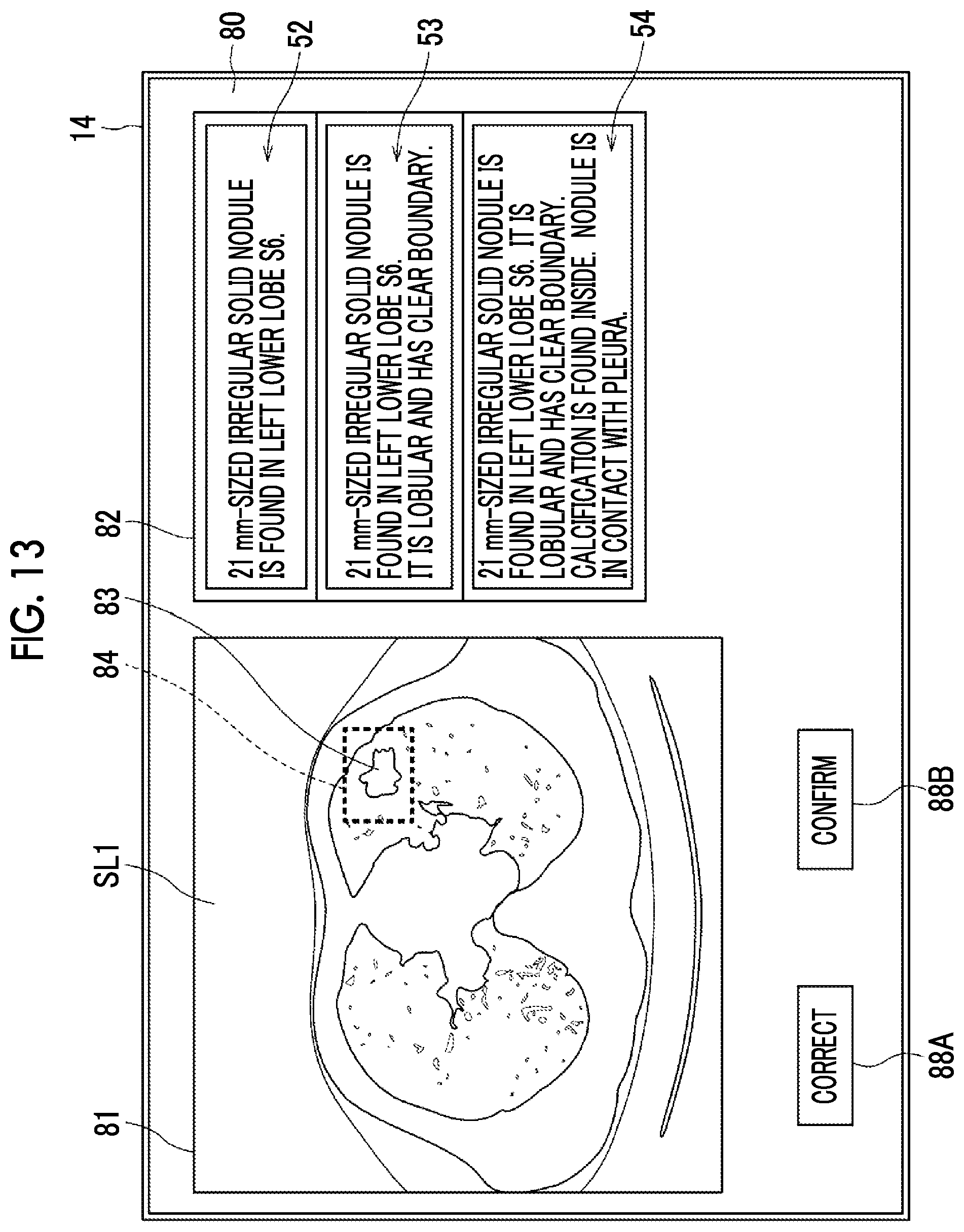Patent US12417838 Figure 11 – Document creation support apparatus, method, and program to generate medical document based on medical images